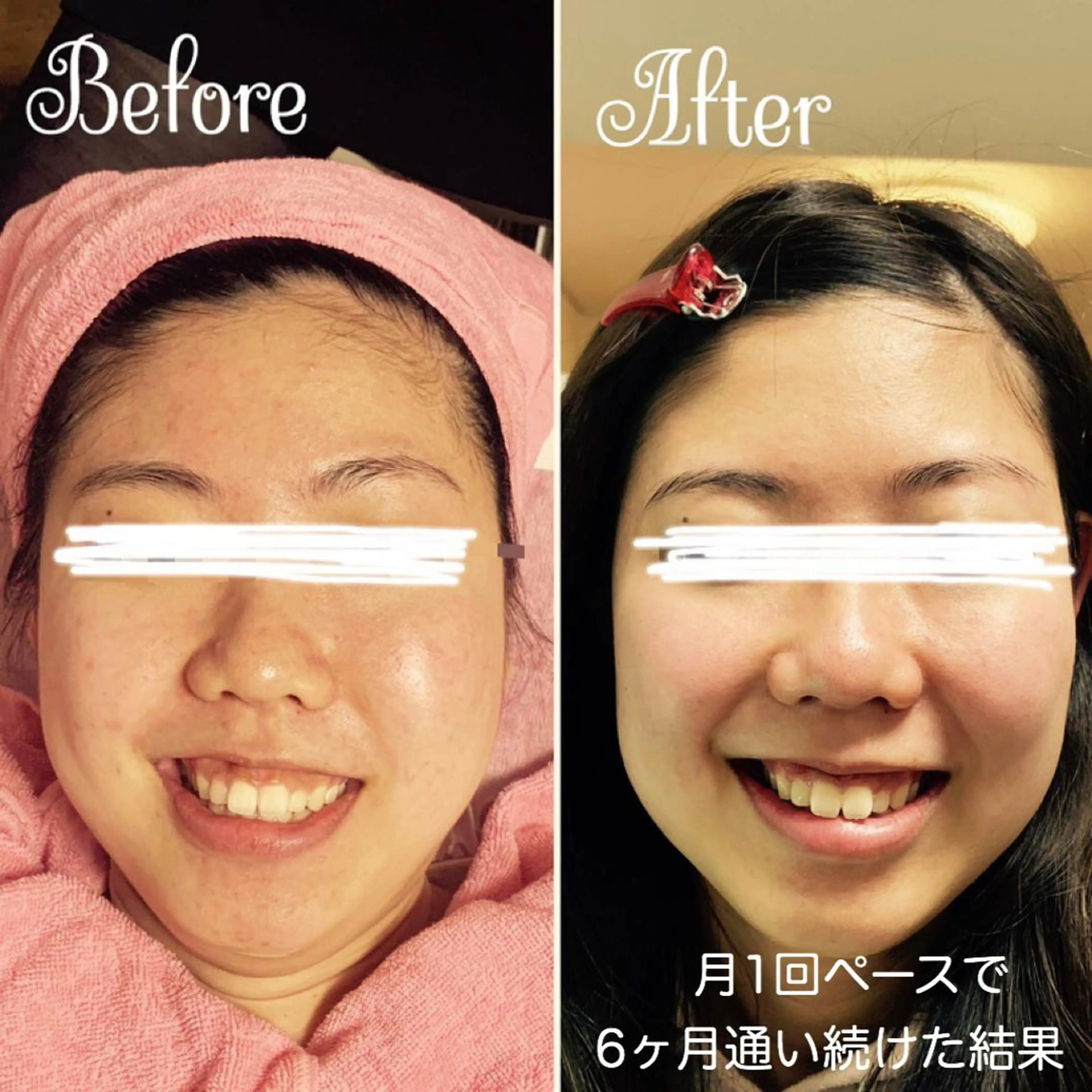 Linomalie エステ/たるみ/脱毛のエステ・リラクイメージ