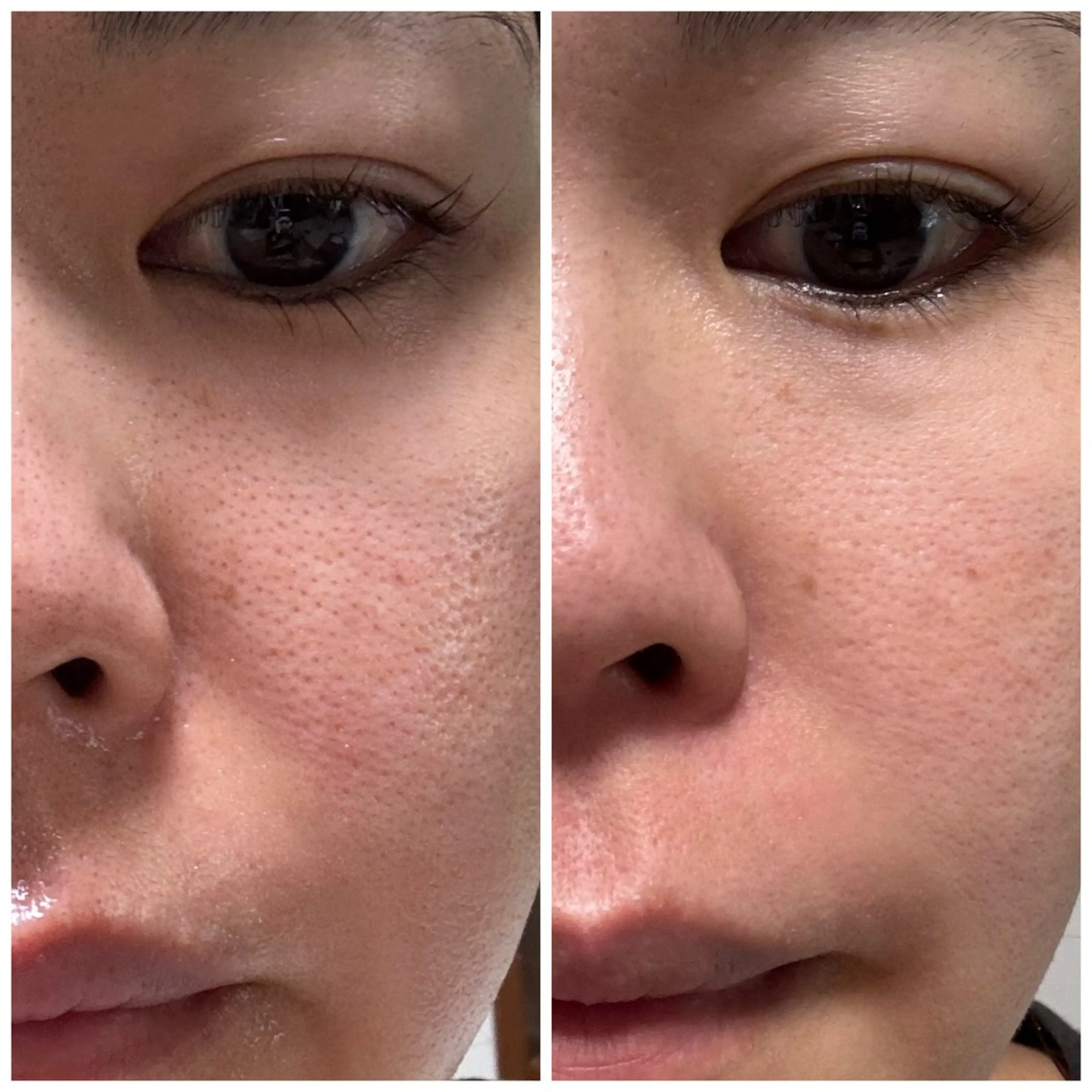 サロンur（ユア） Rieのエステ・リラクイメージ