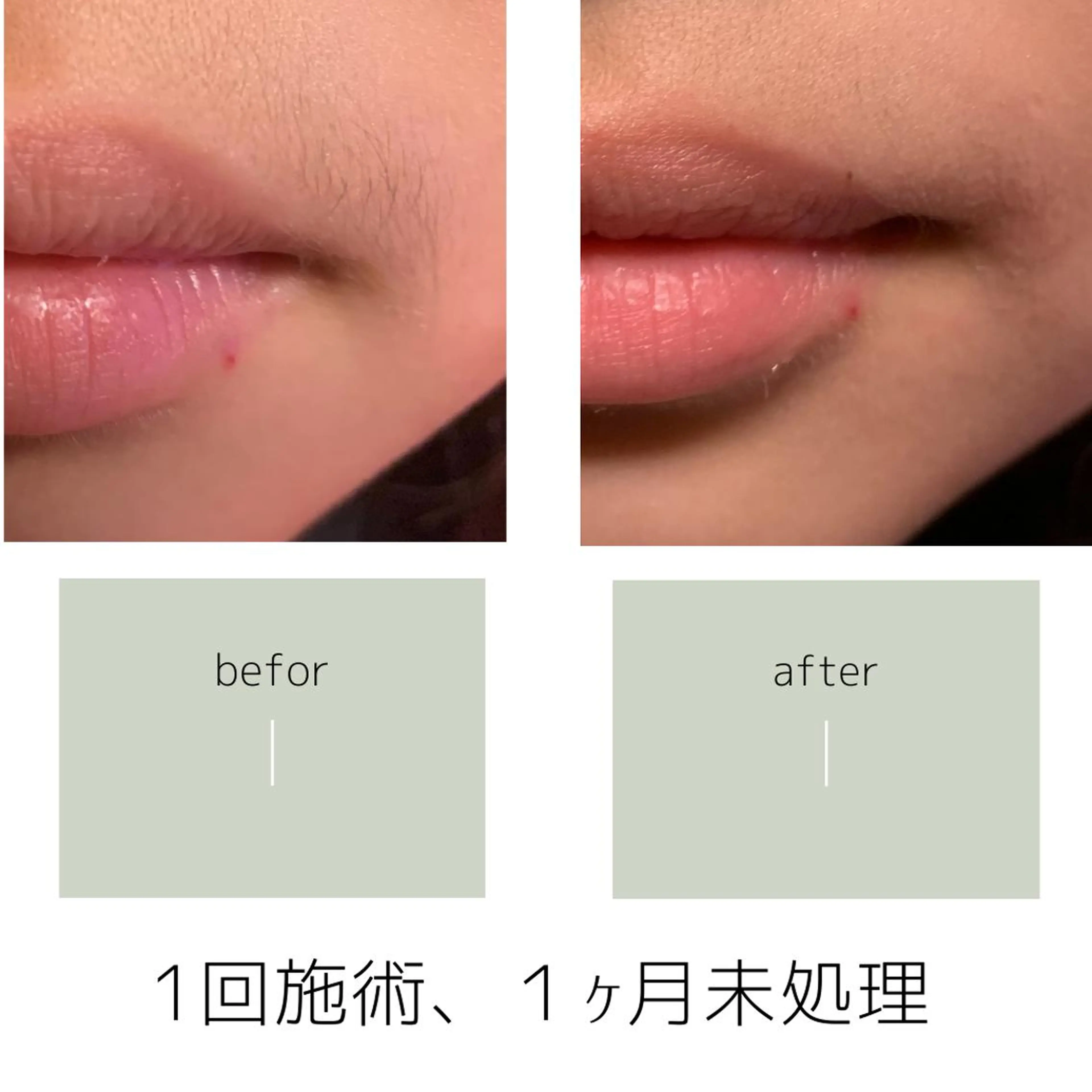 salon mijoaのエステ・リラクイメージ