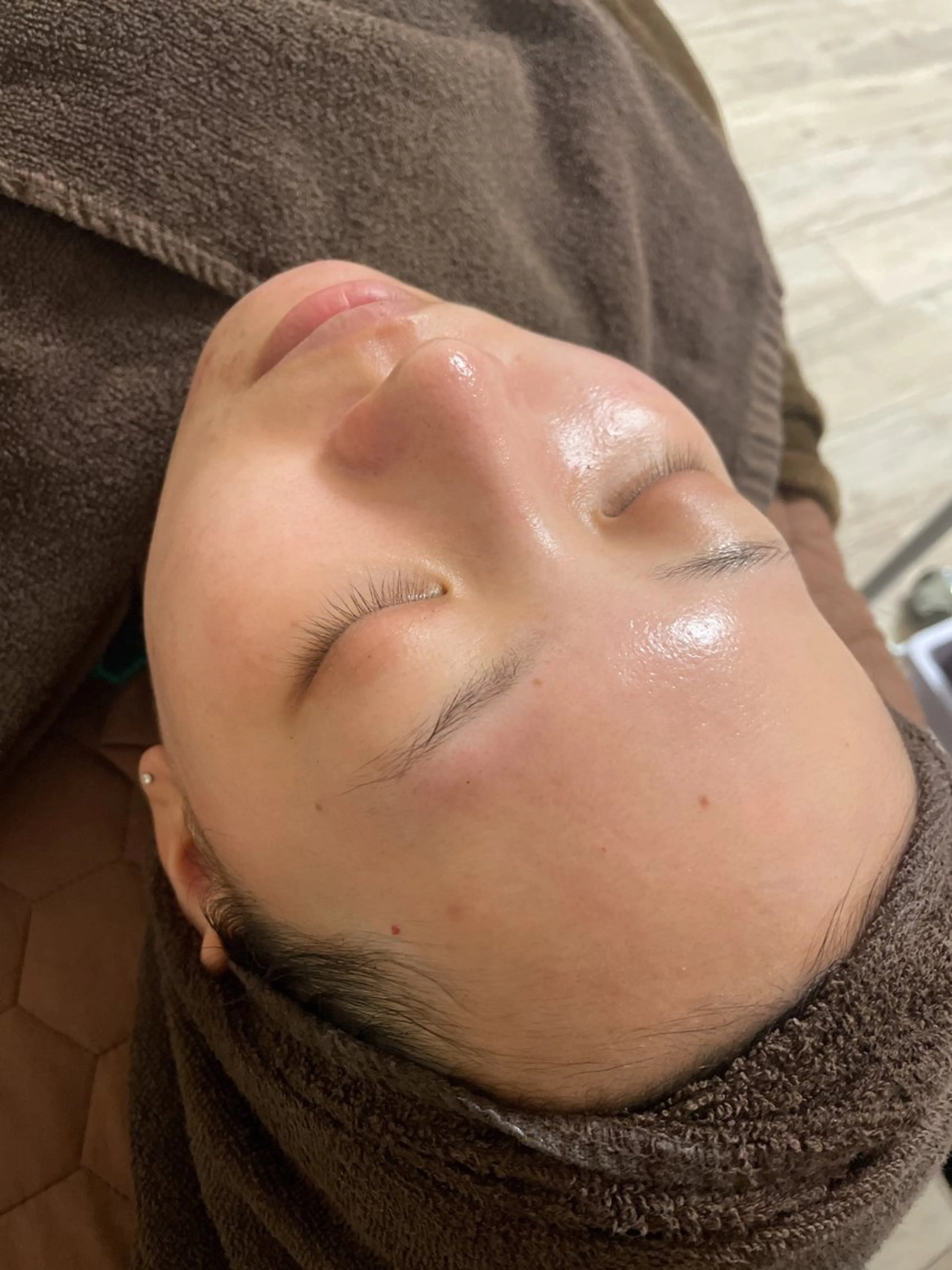 肌質改善・小顔サロン 20代店長RINNAのエステ・リラクイメージ