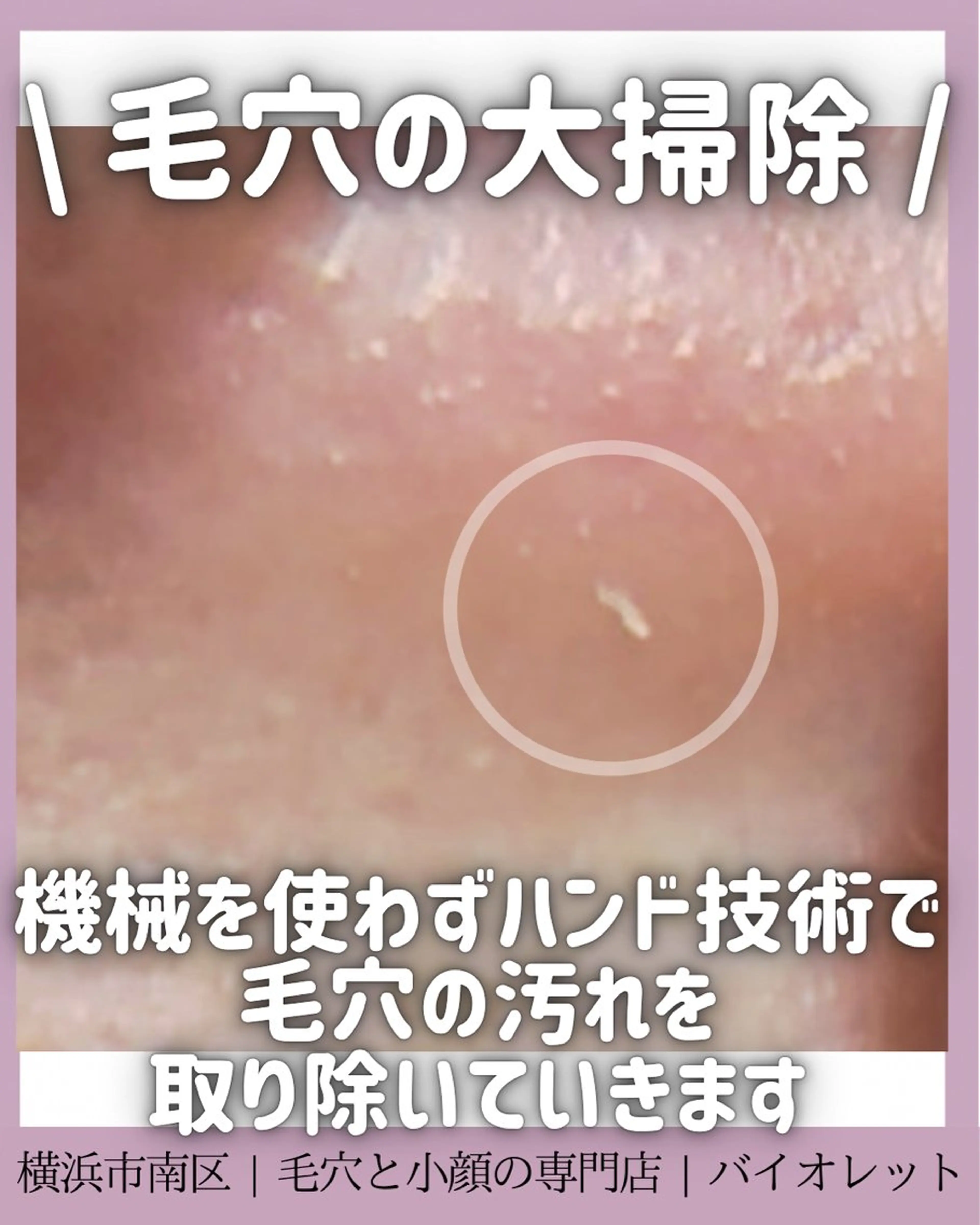 毛穴と耳つぼ専門店 バイオレット　りののその他イメージ