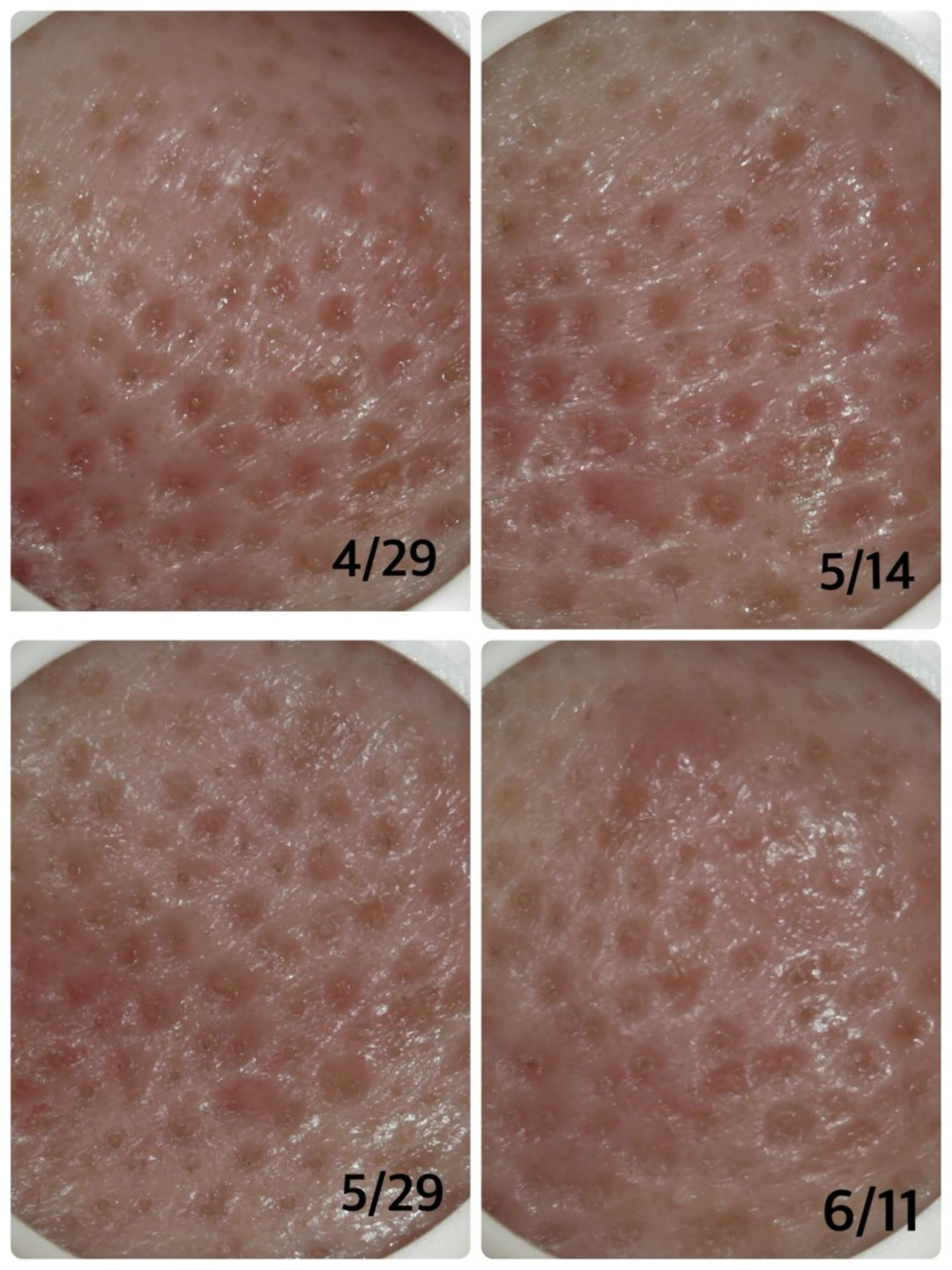 エステ リラク メナード片町 やまもと みくのエステ・リラクイメージ