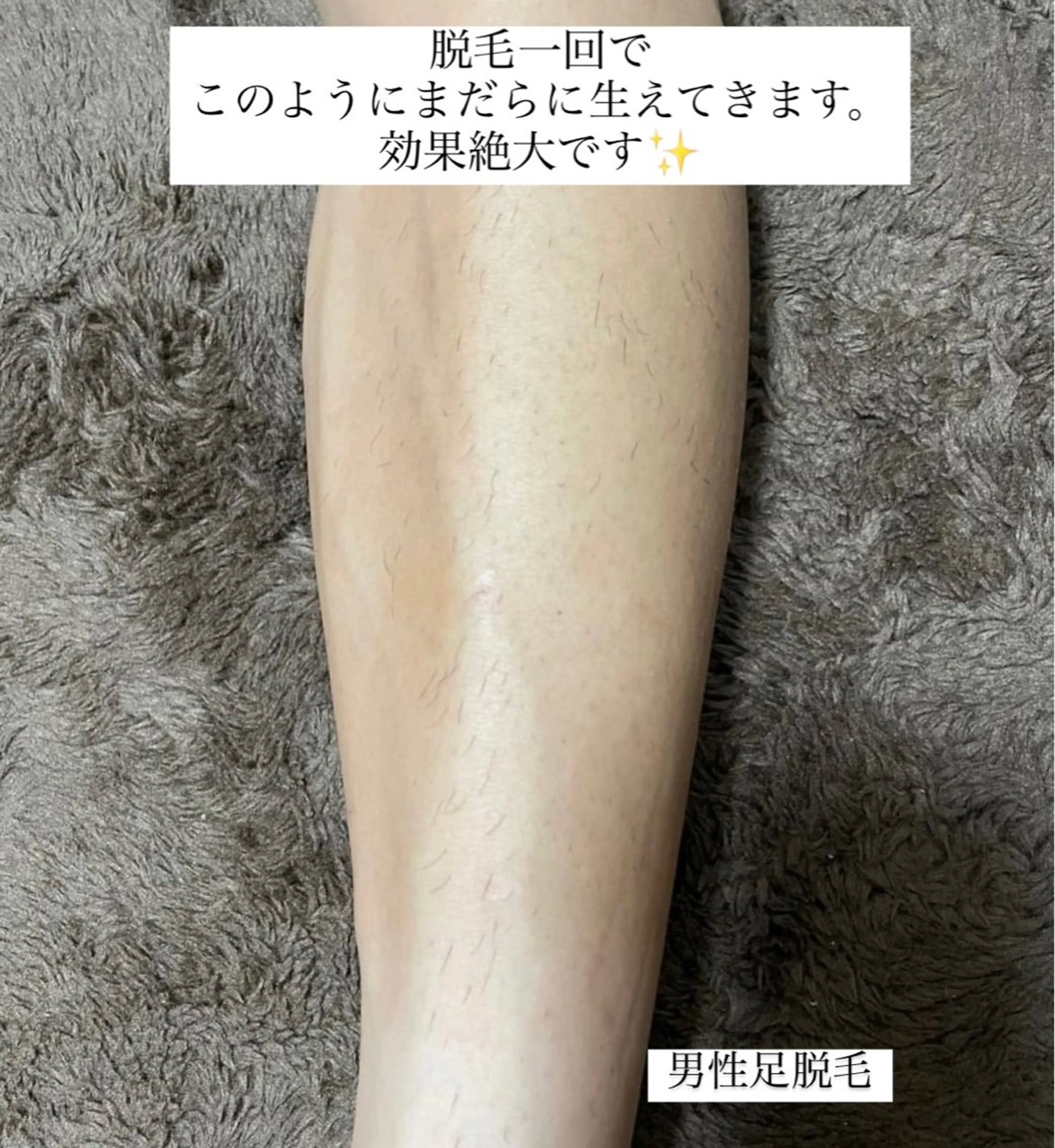 メンズ Anela .のマツエク・マツパデザイン