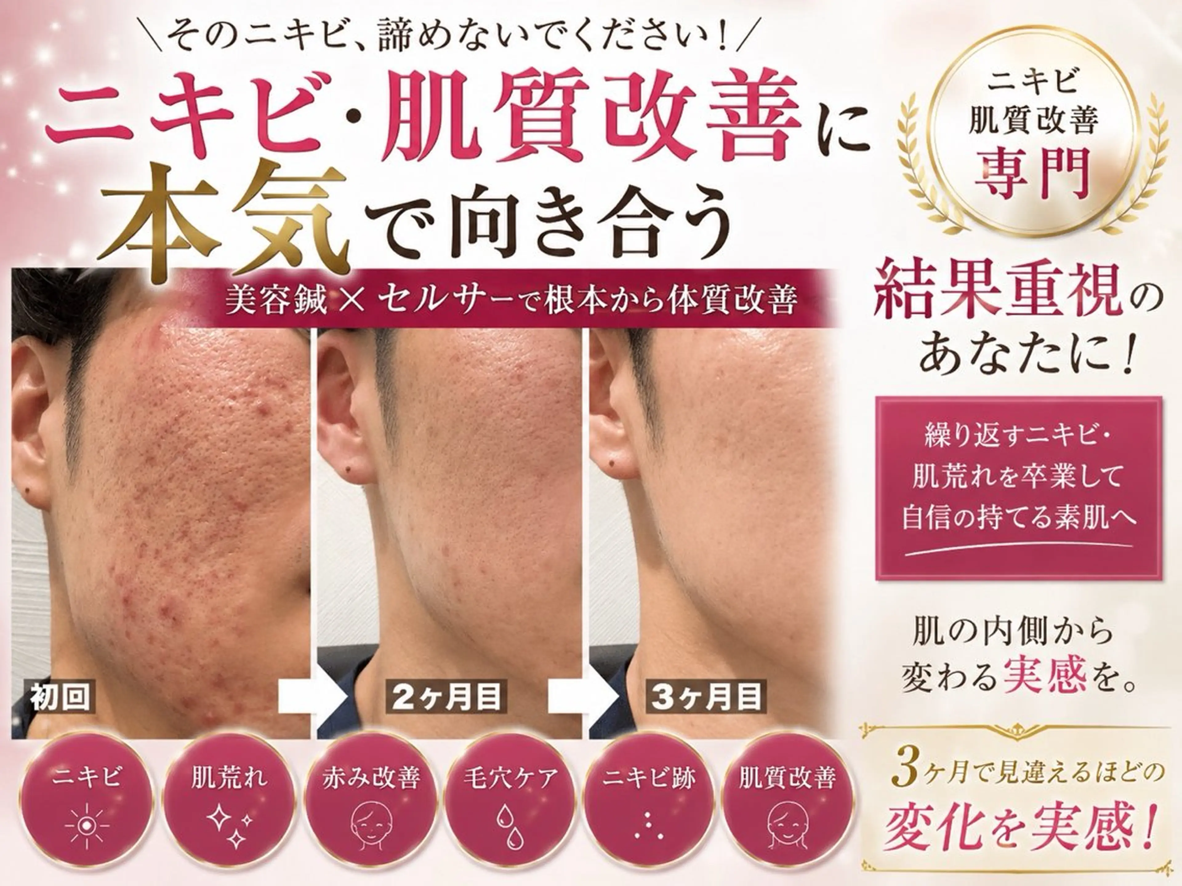肌質改善×美容鍼 ゆいのエステ・リラクイメージ