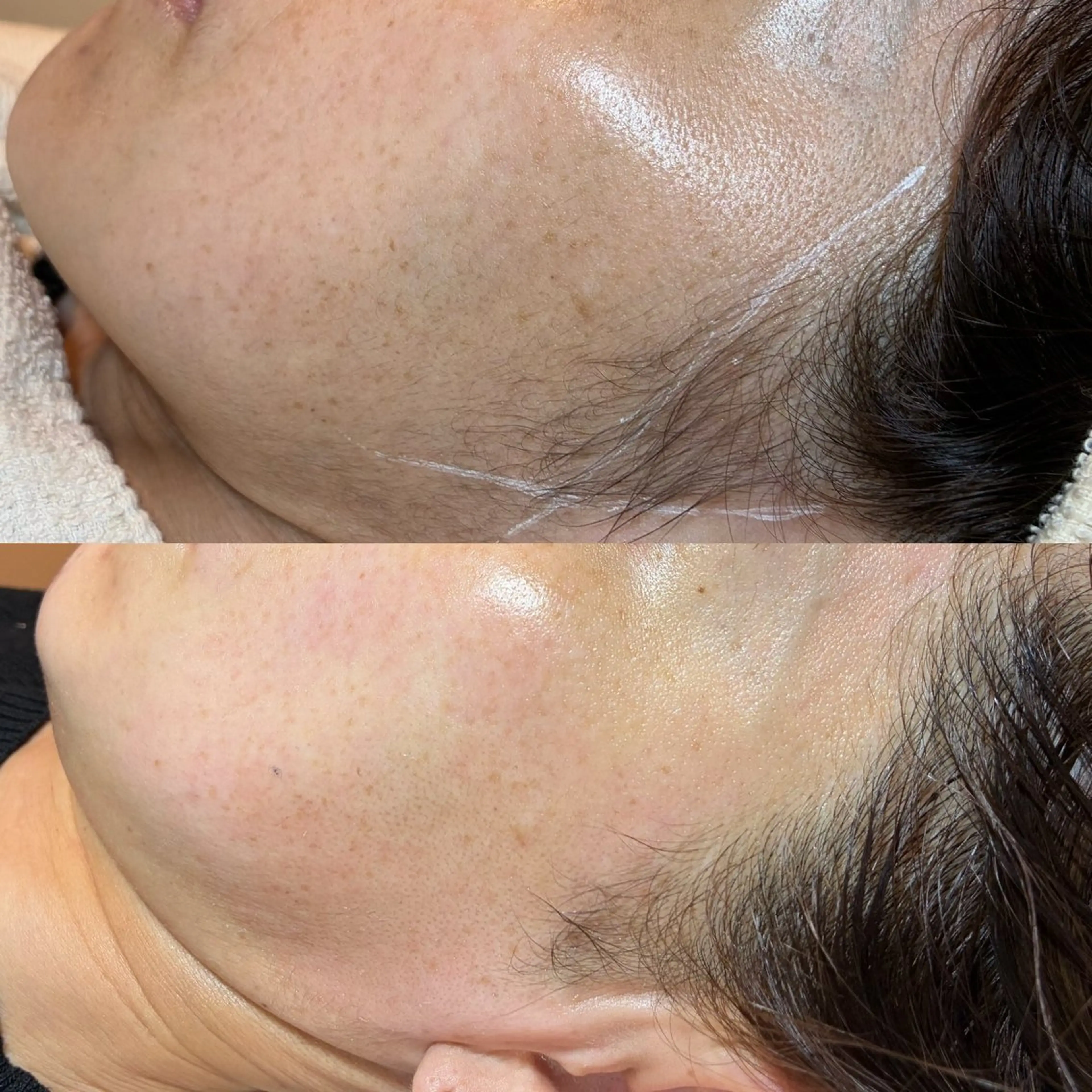 【くすみ徹底ケア】フェイスワックス＋透明感UPパック/化粧ノリUPの写真