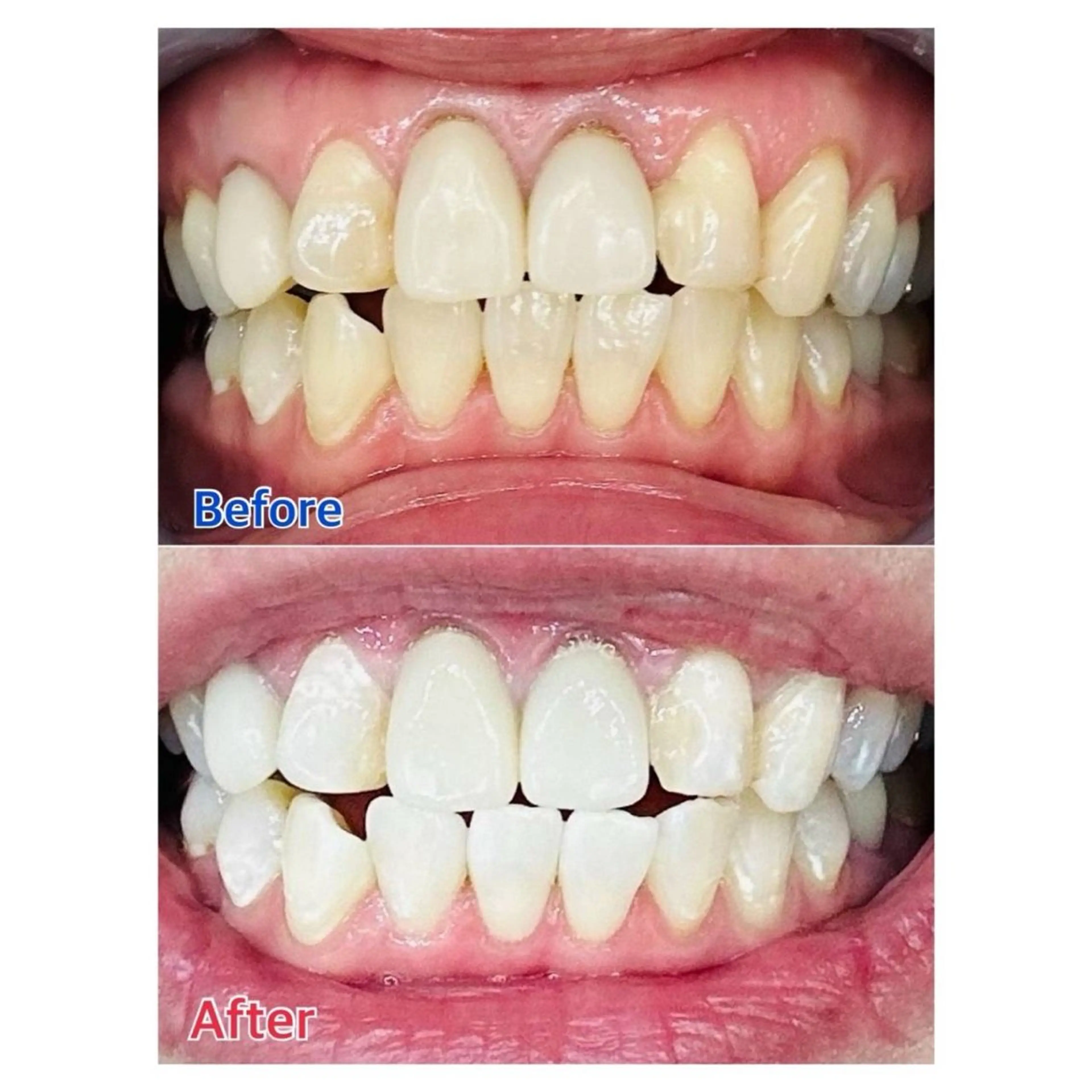 Melty 輝のその他イメージ