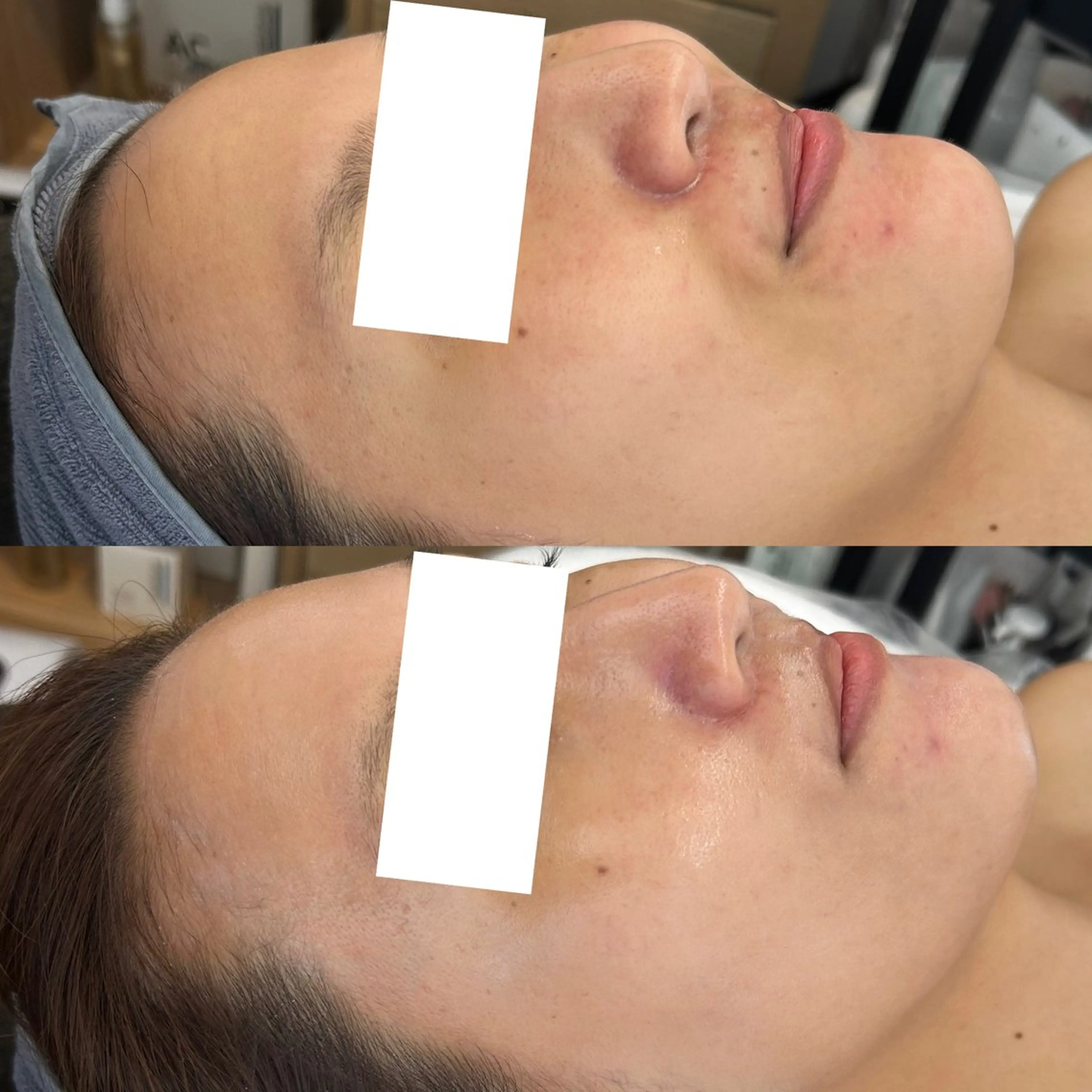 エステ 韓国🇰🇷価格 サロン_Nbibiの眉毛・アイブロウイメージ