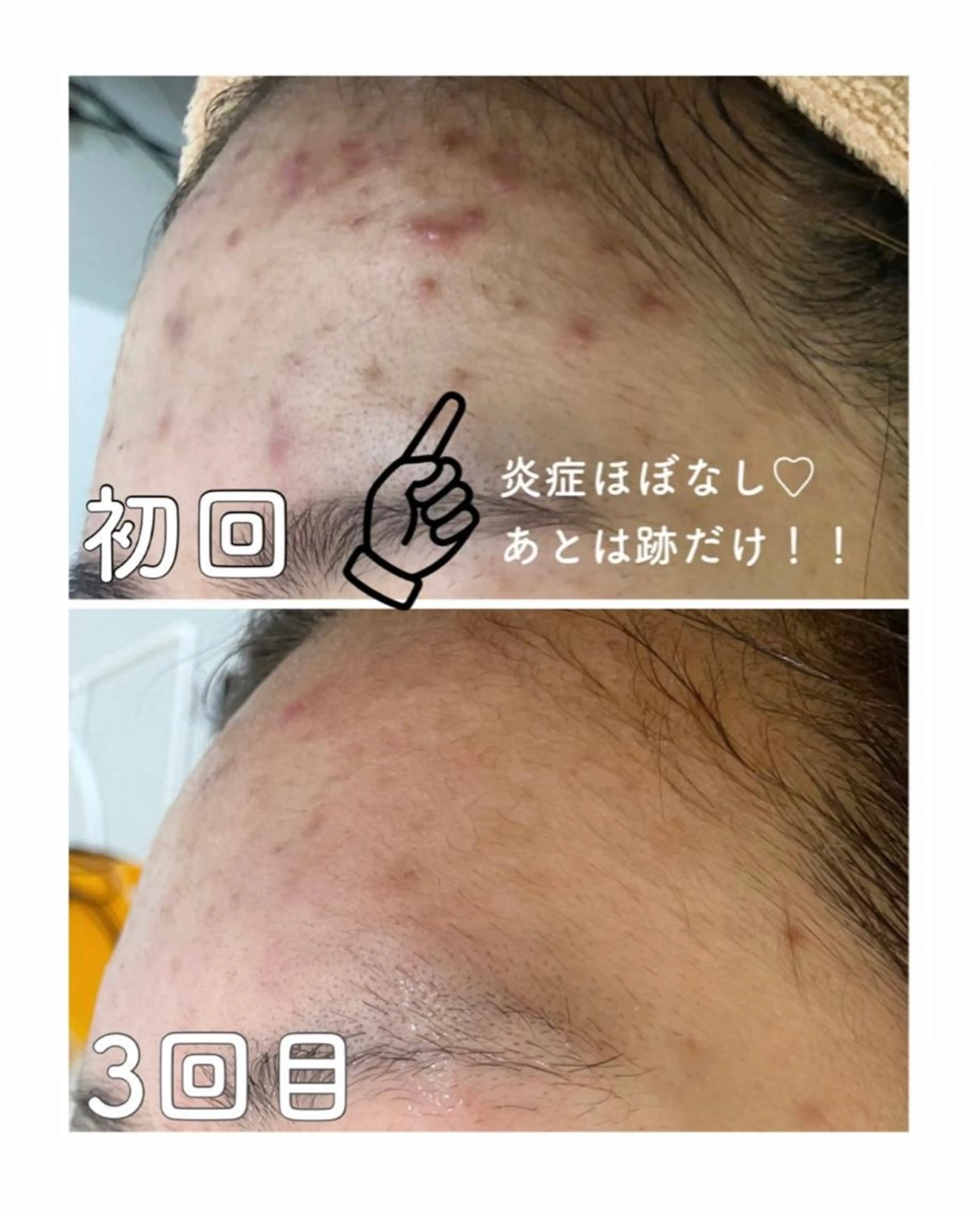 都度払い肌改善専門店 店長二上文香のエステ・リラクイメージ