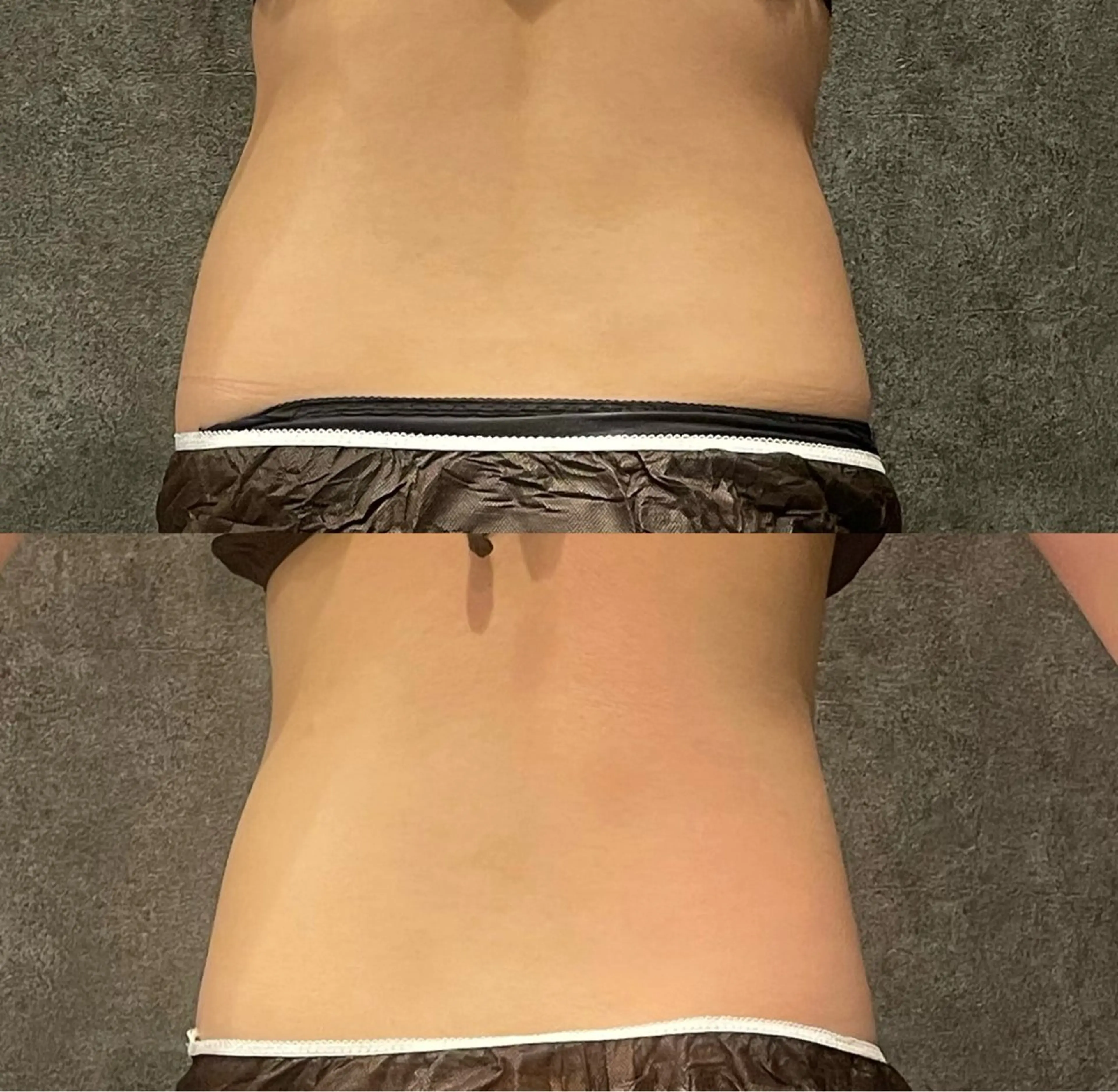 エステ Re:Belle所属・Re:Belle 久留米 : 中島のエステ・リラクイメージ