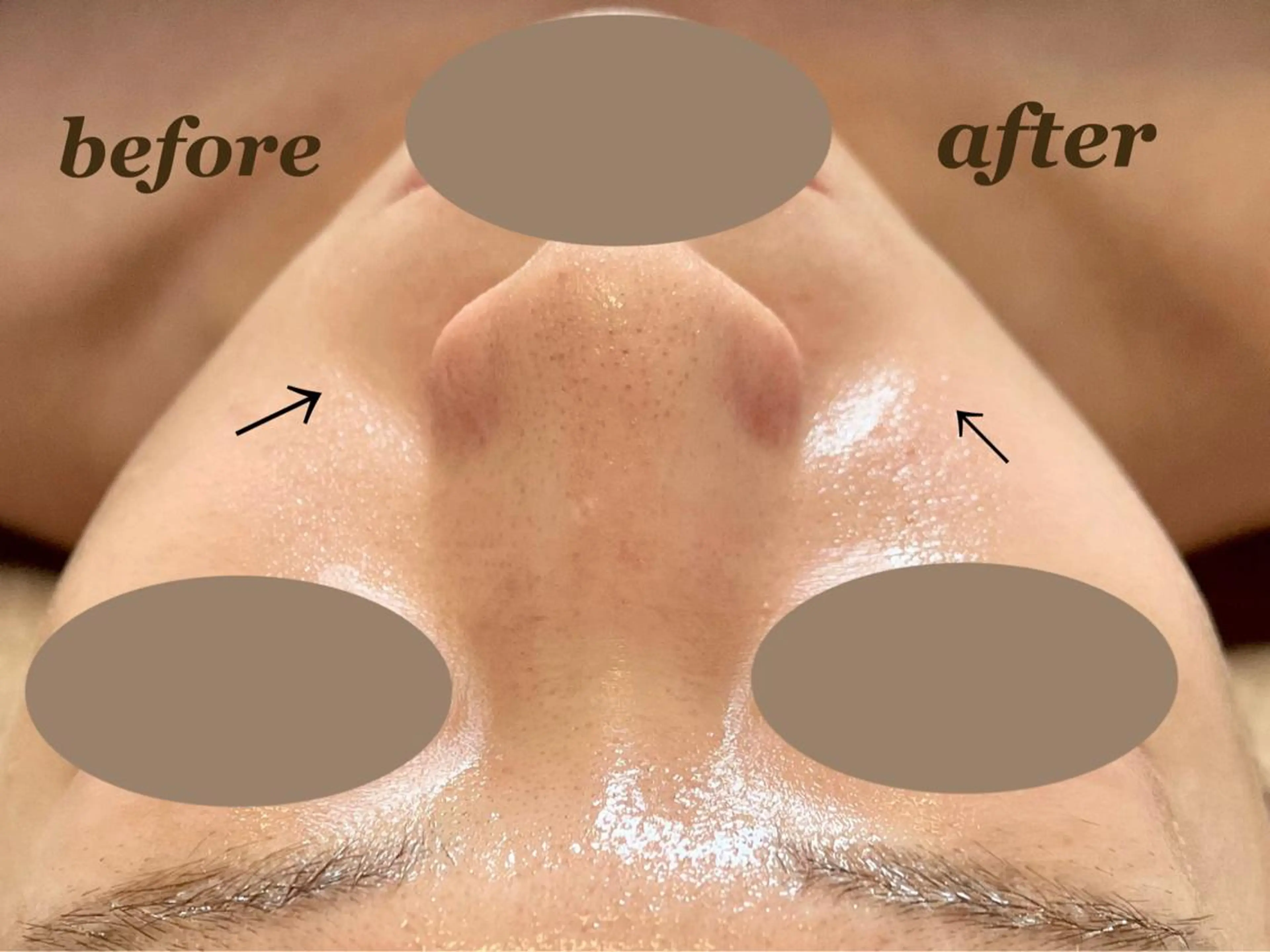 total beauty DIAのネイルデザイン