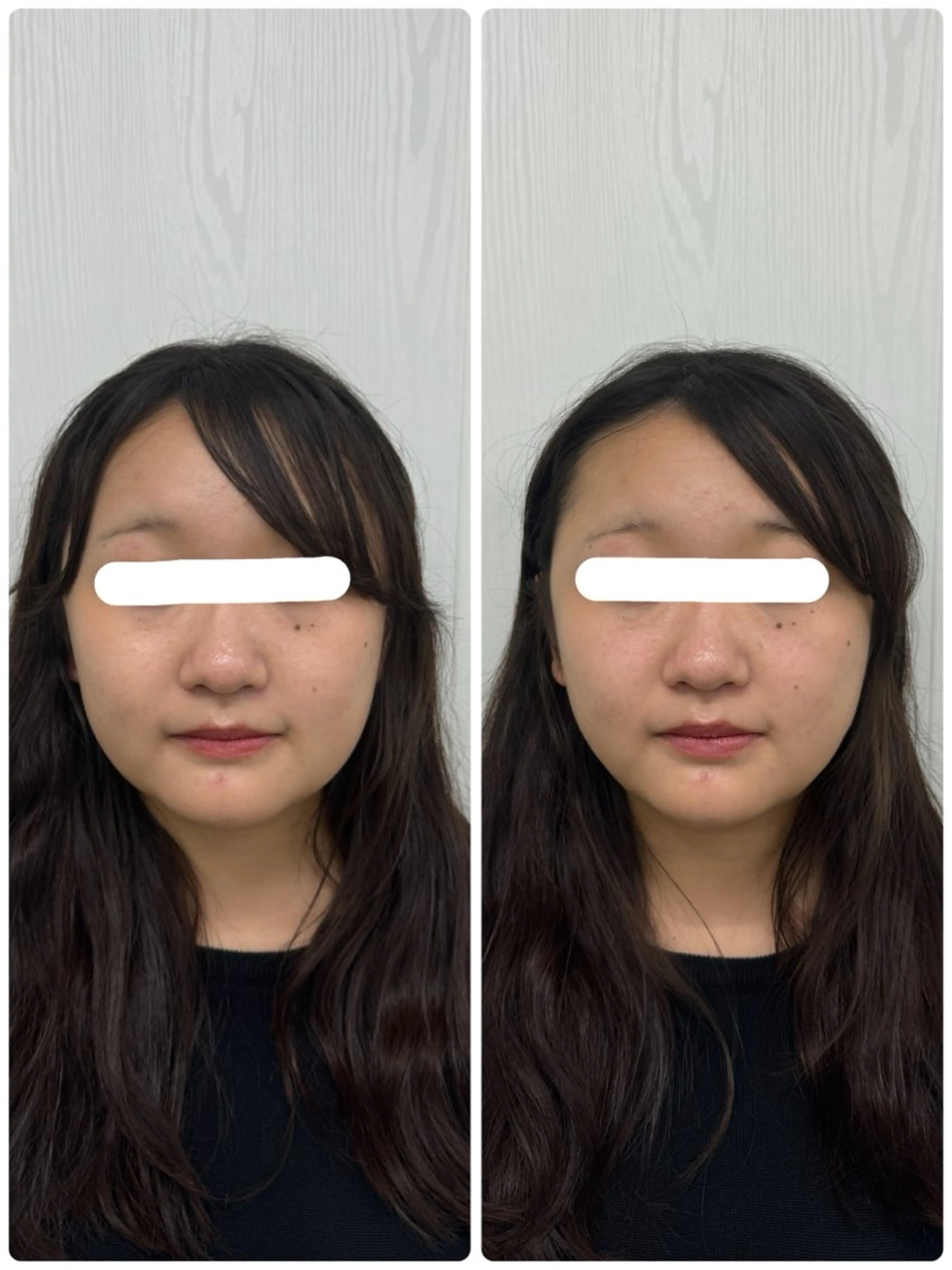 エステ リラク 美容鍼×小顔矯正 ×美容整体　浜川泰仁のエステ・リラクイメージ