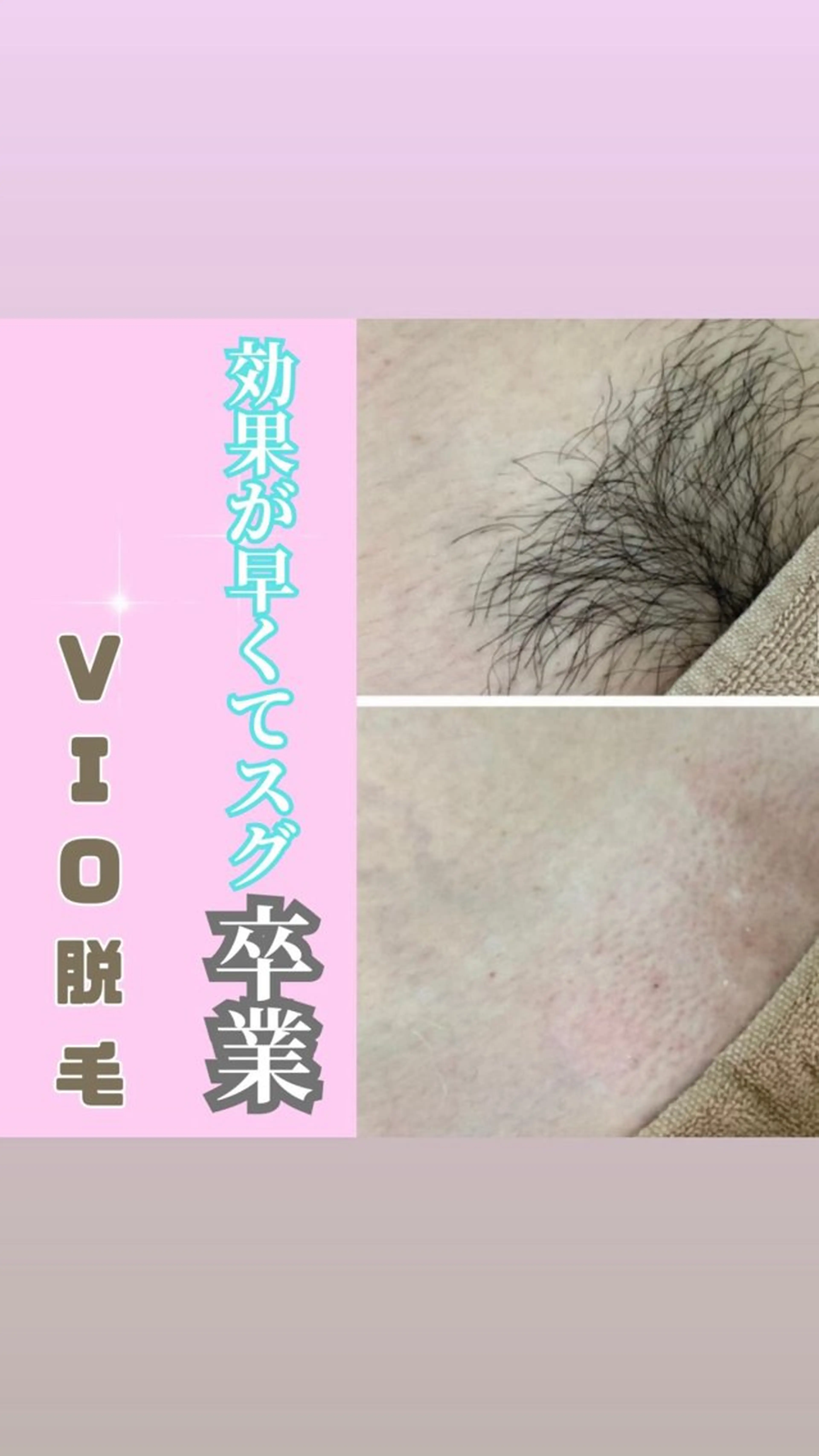 WAX・肌質改善・毛 穴洗浄/林愛真のエステ・リラクイメージ