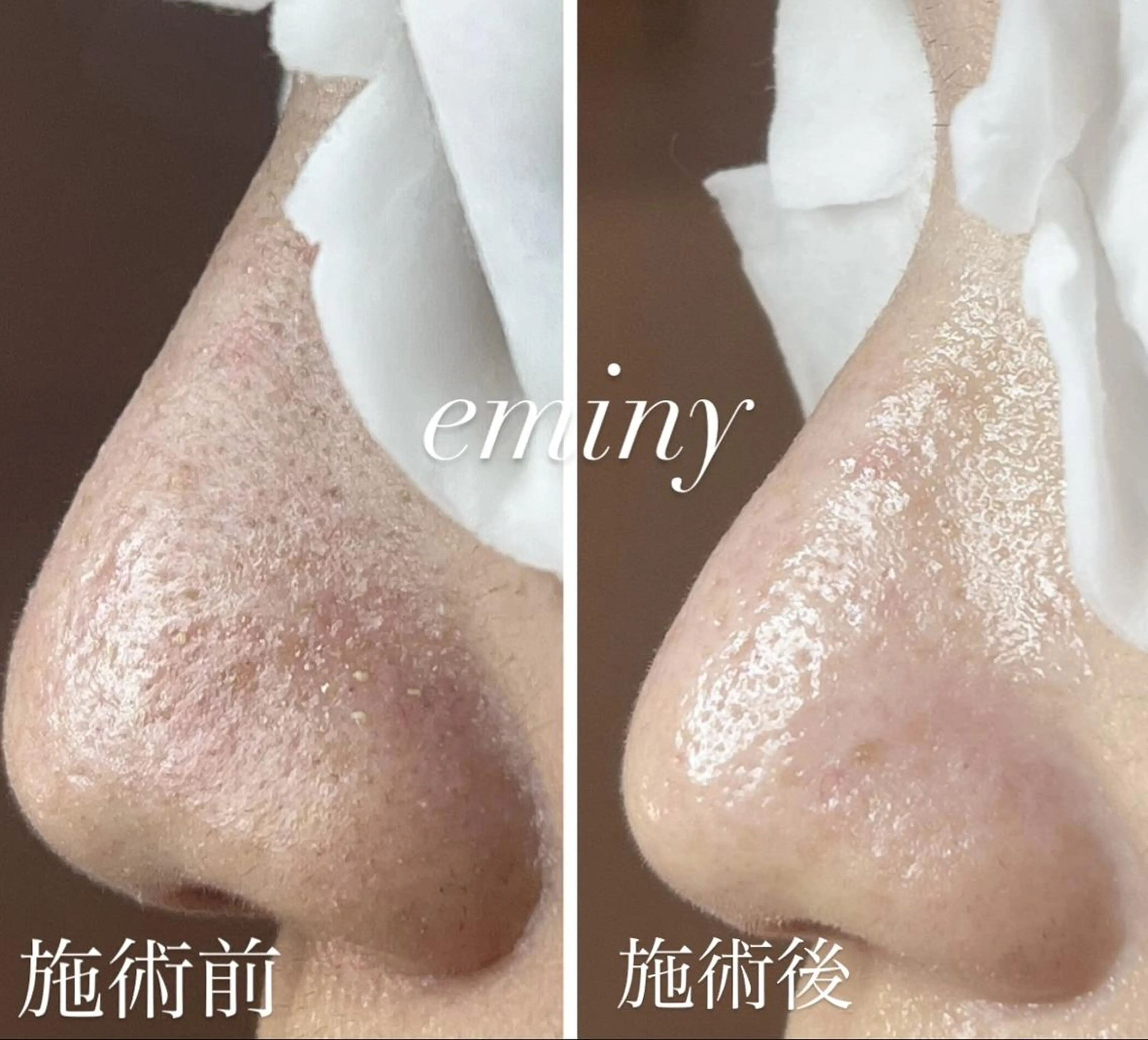 EMINY （エステティシャン）のエステ・リラクイメージ