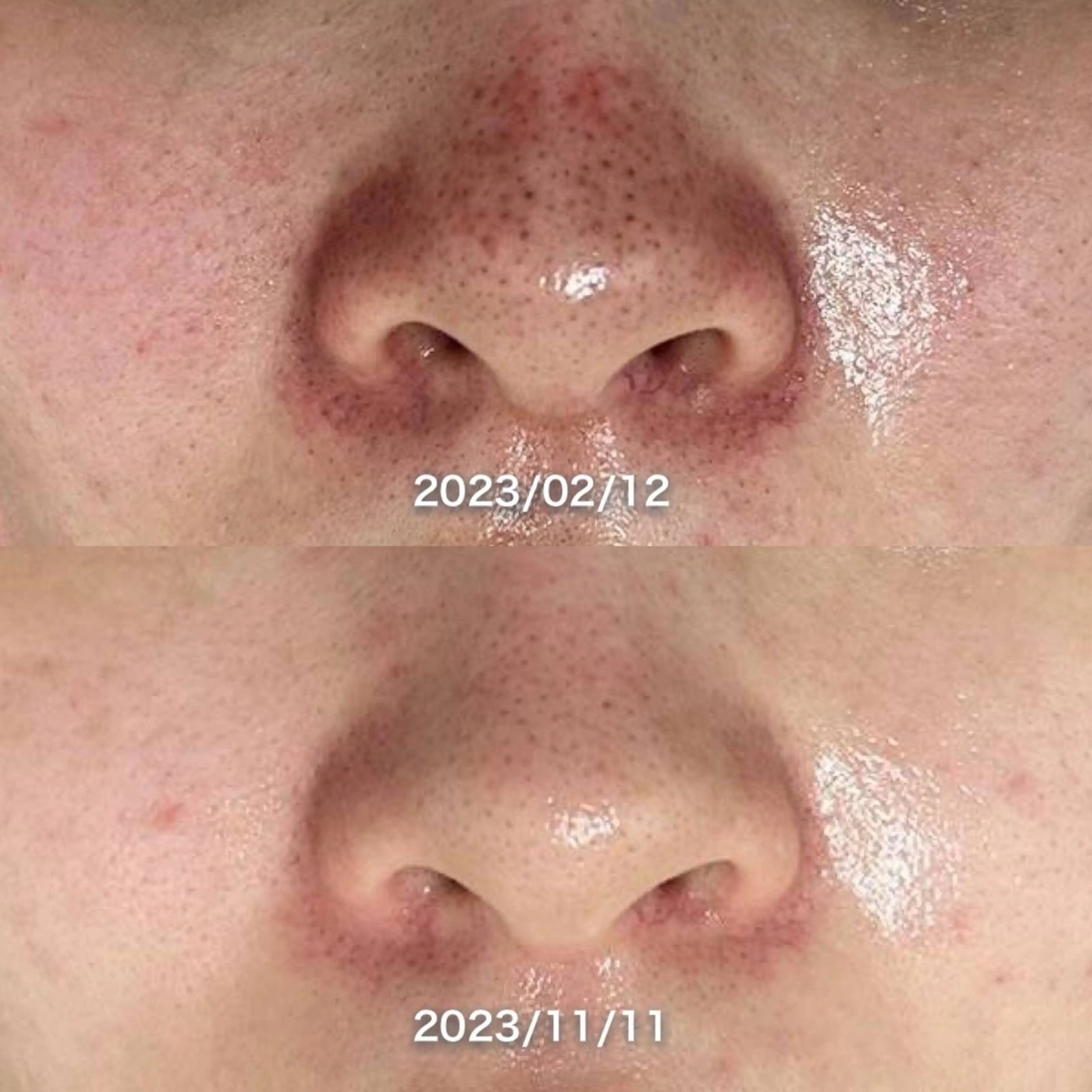 エステ 韓国美肌/肌質改善 【天神】のエステ・リラクイメージ