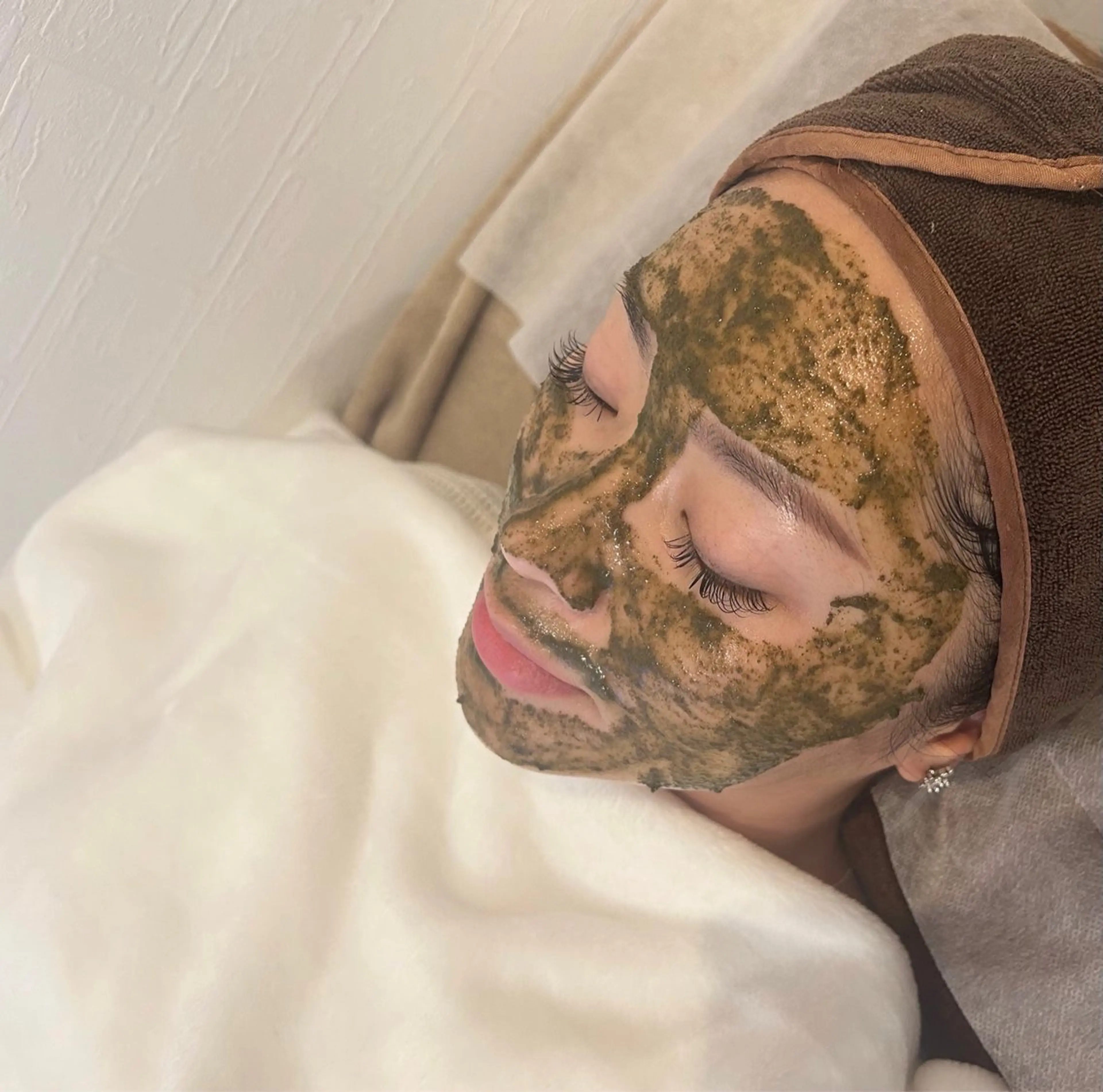 【剥離ありハーブピーリング】繰り返すニキビやニキビ跡・開き毛穴・シミ・シワ・くすみなどを最短改善✨の写真