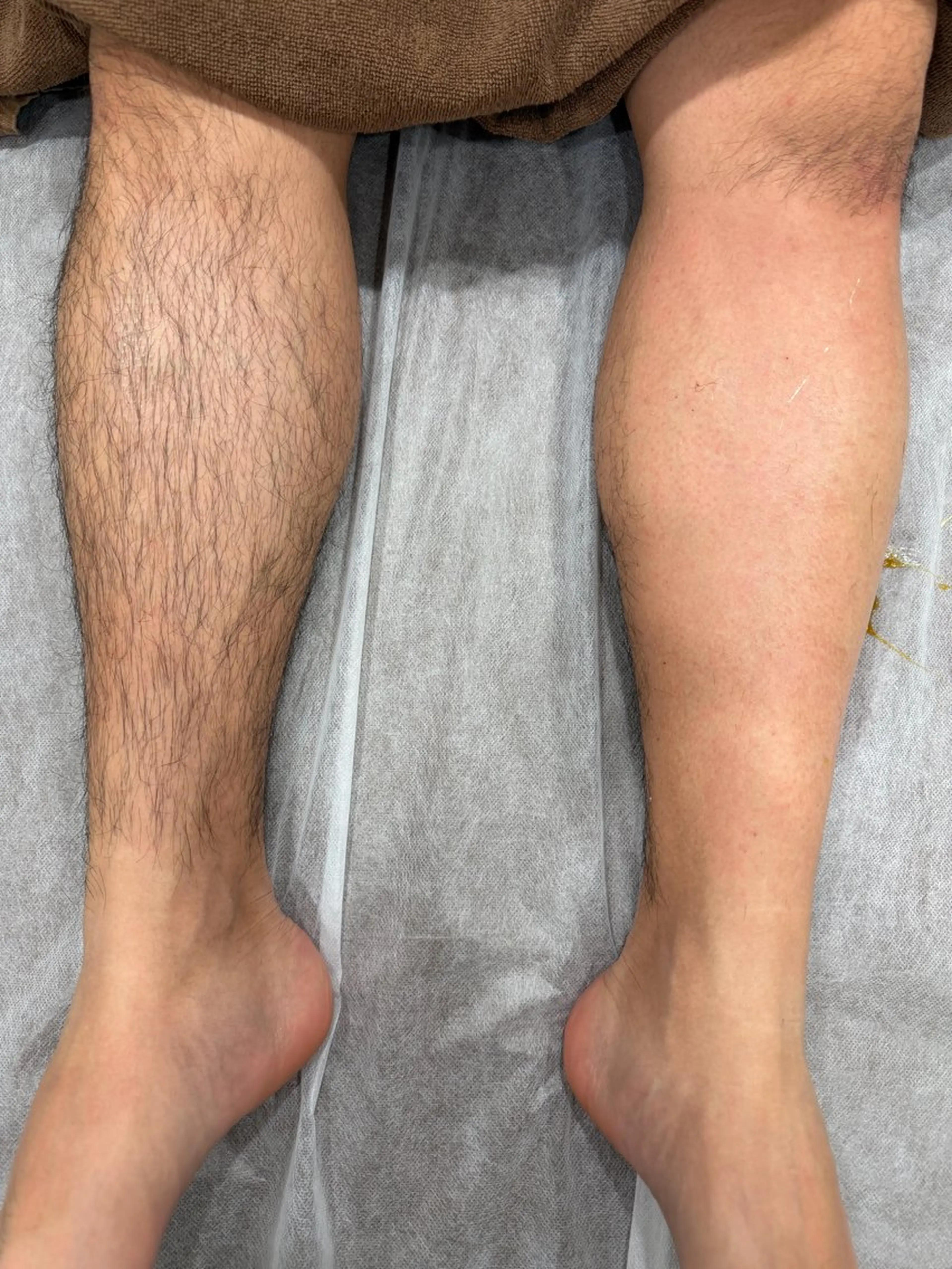 脱毛 脱毛サロンMIRUS Yuukaのエステ・リラクイメージ