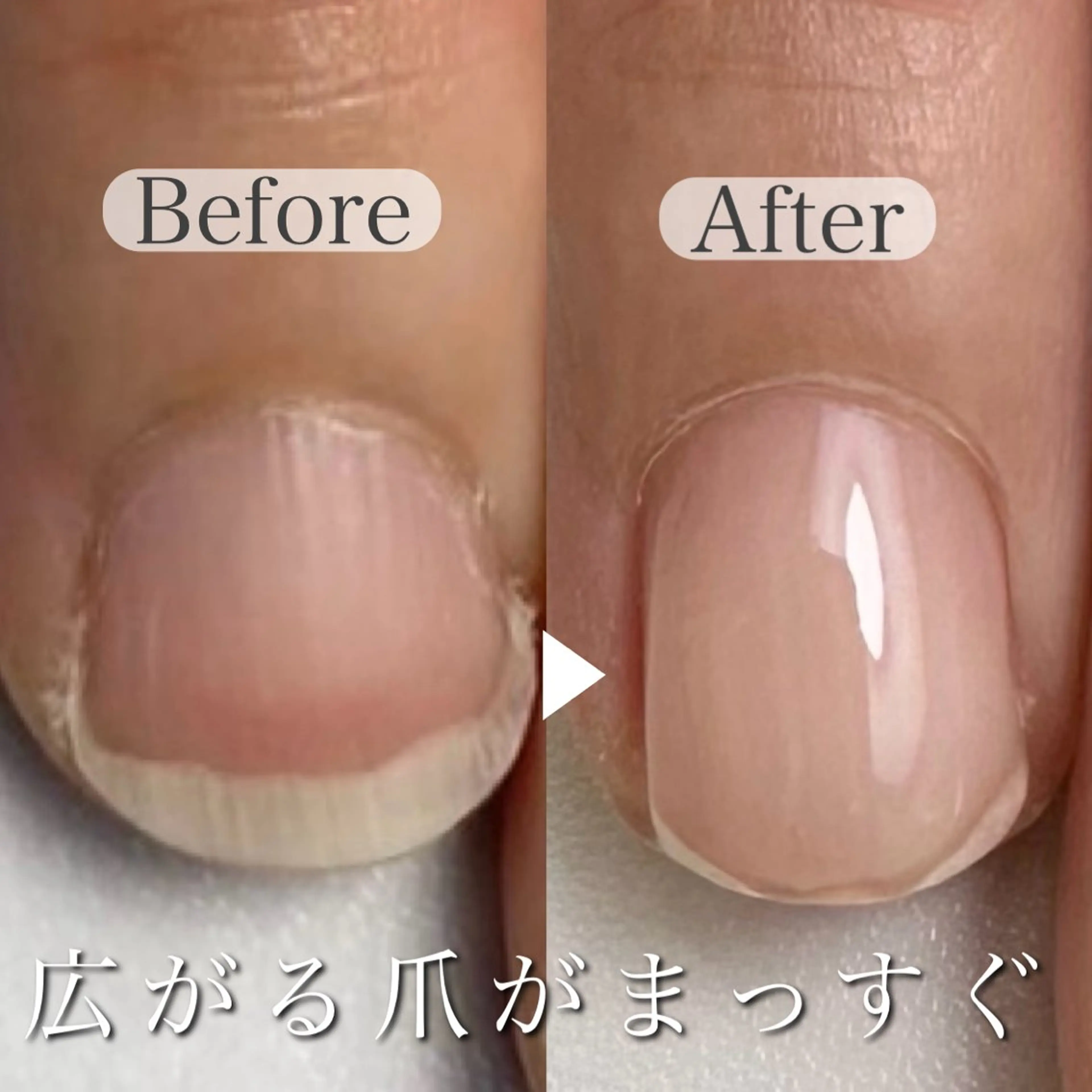 ◎もっと美爪に！縦長爪を目指すコースの写真