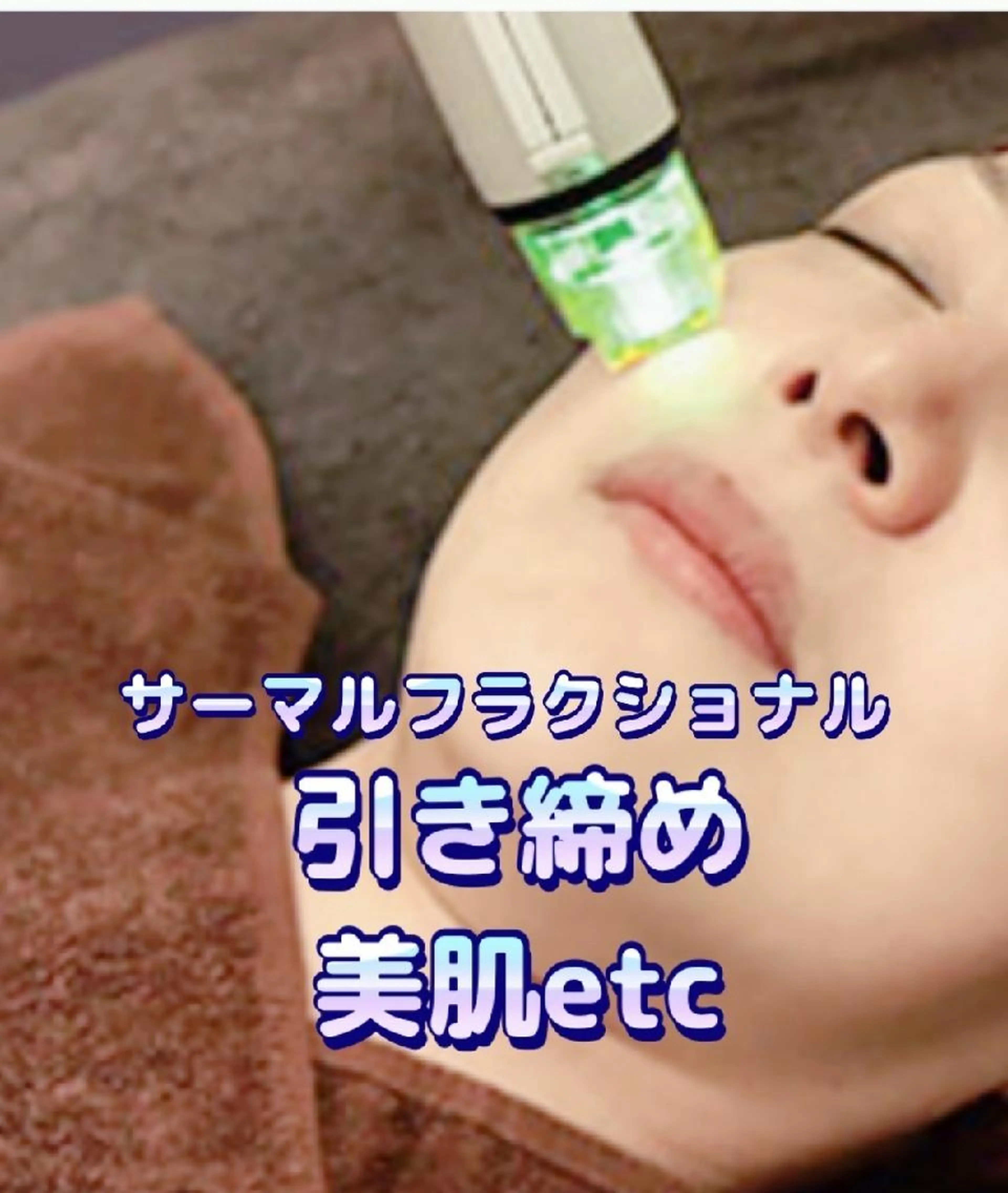 【サーマルフラクショナル＆顔筋フェイシャル❤】45分　サーマルでギュッと❗引き締め＆ハンドで顔筋アプローチ🌟の写真
