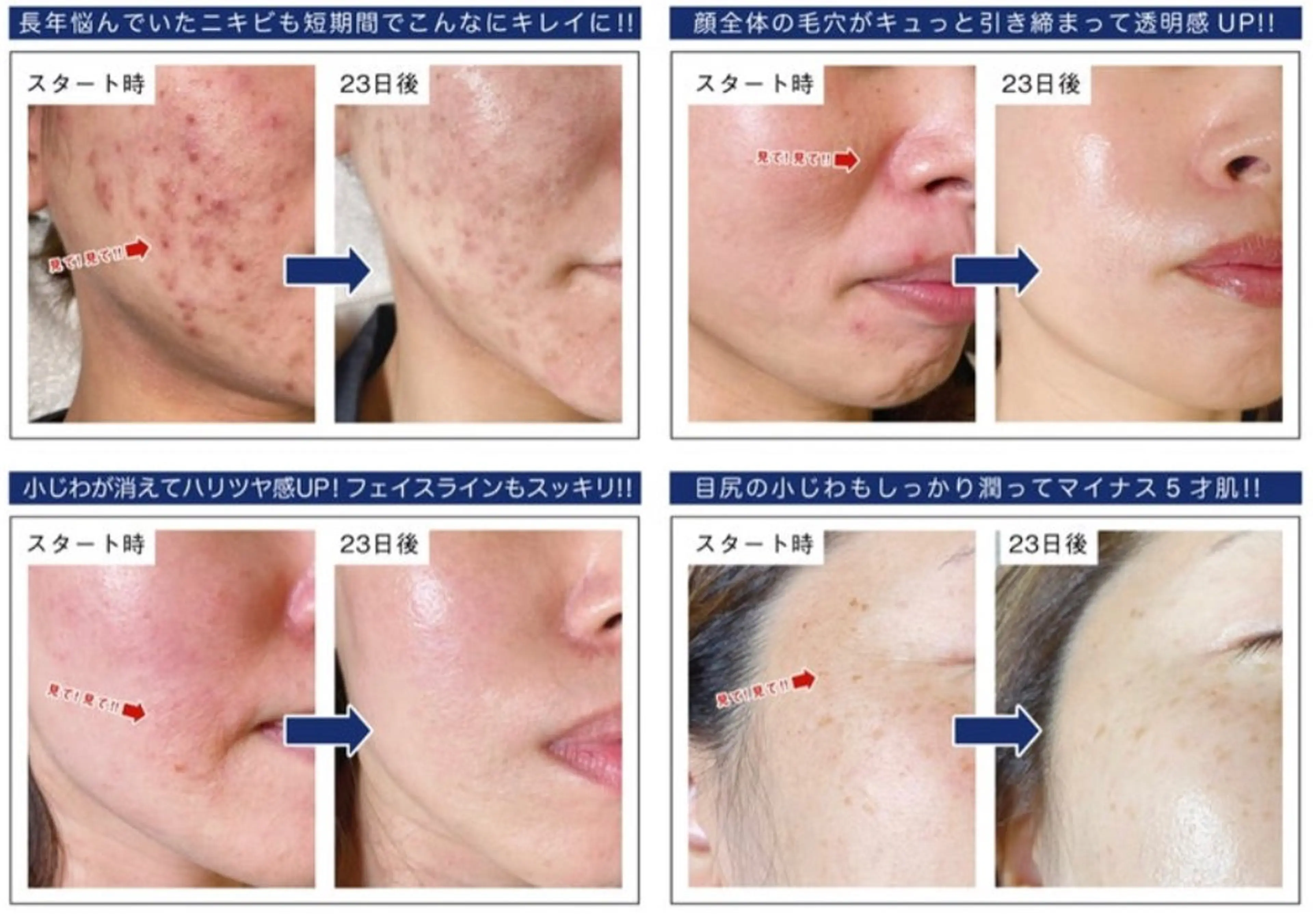 アンベリーノ Yuuriのエステ・リラクイメージ