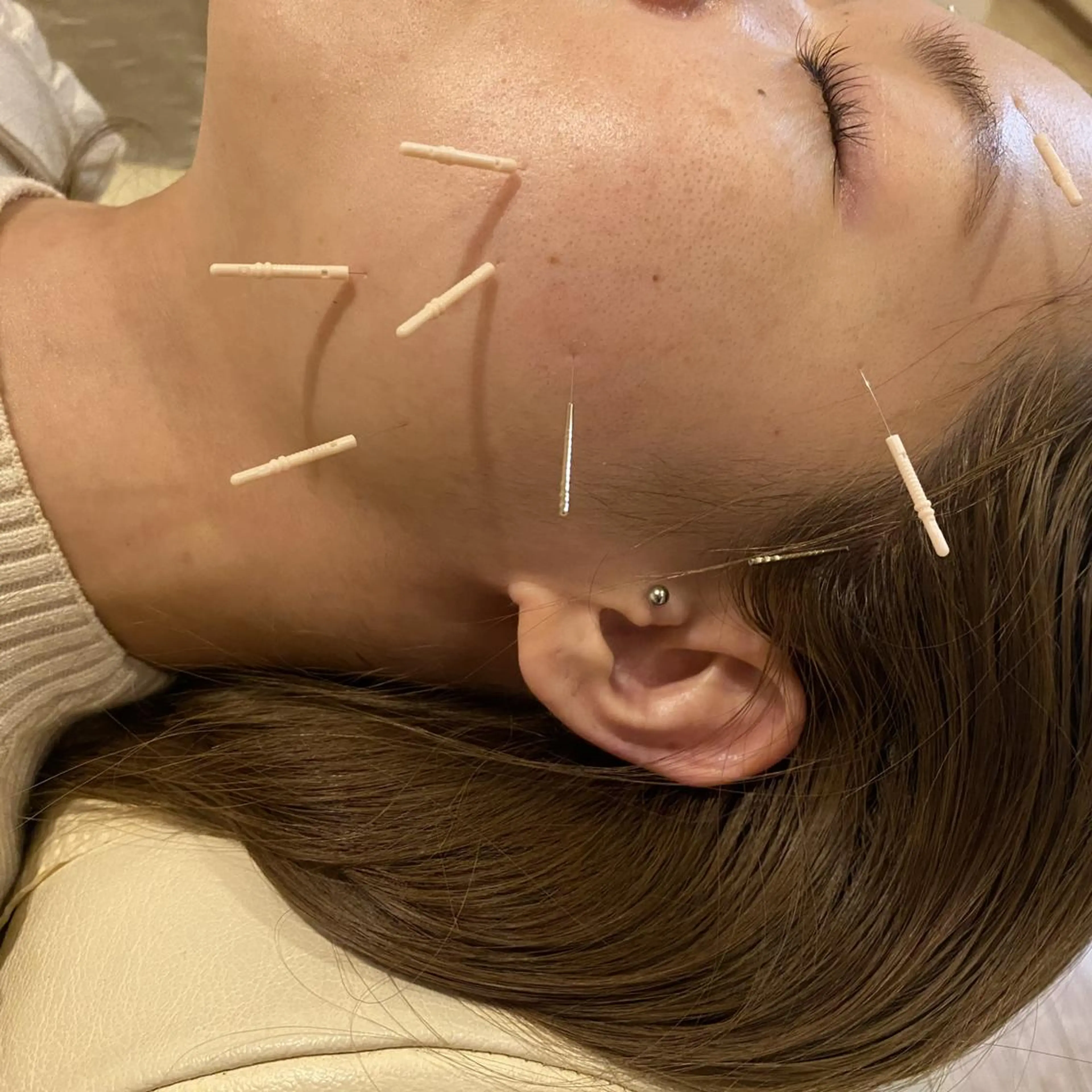 むくみたるみ専門☆ 美容鍼・小顔矯正のエステ・リラクイメージ