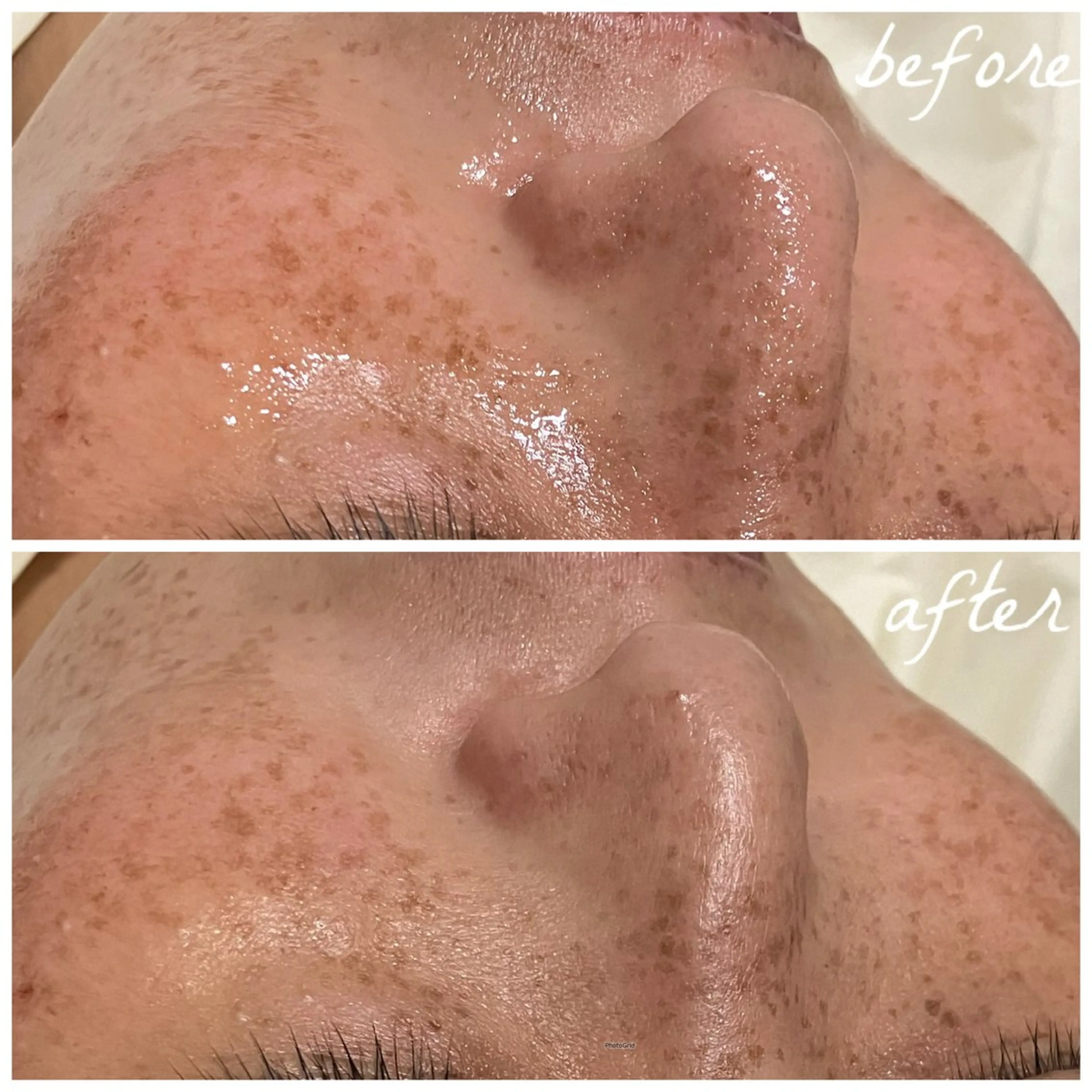 メンズ エステ メナード岐阜市茜部 杉浦のエステ・リラクイメージ