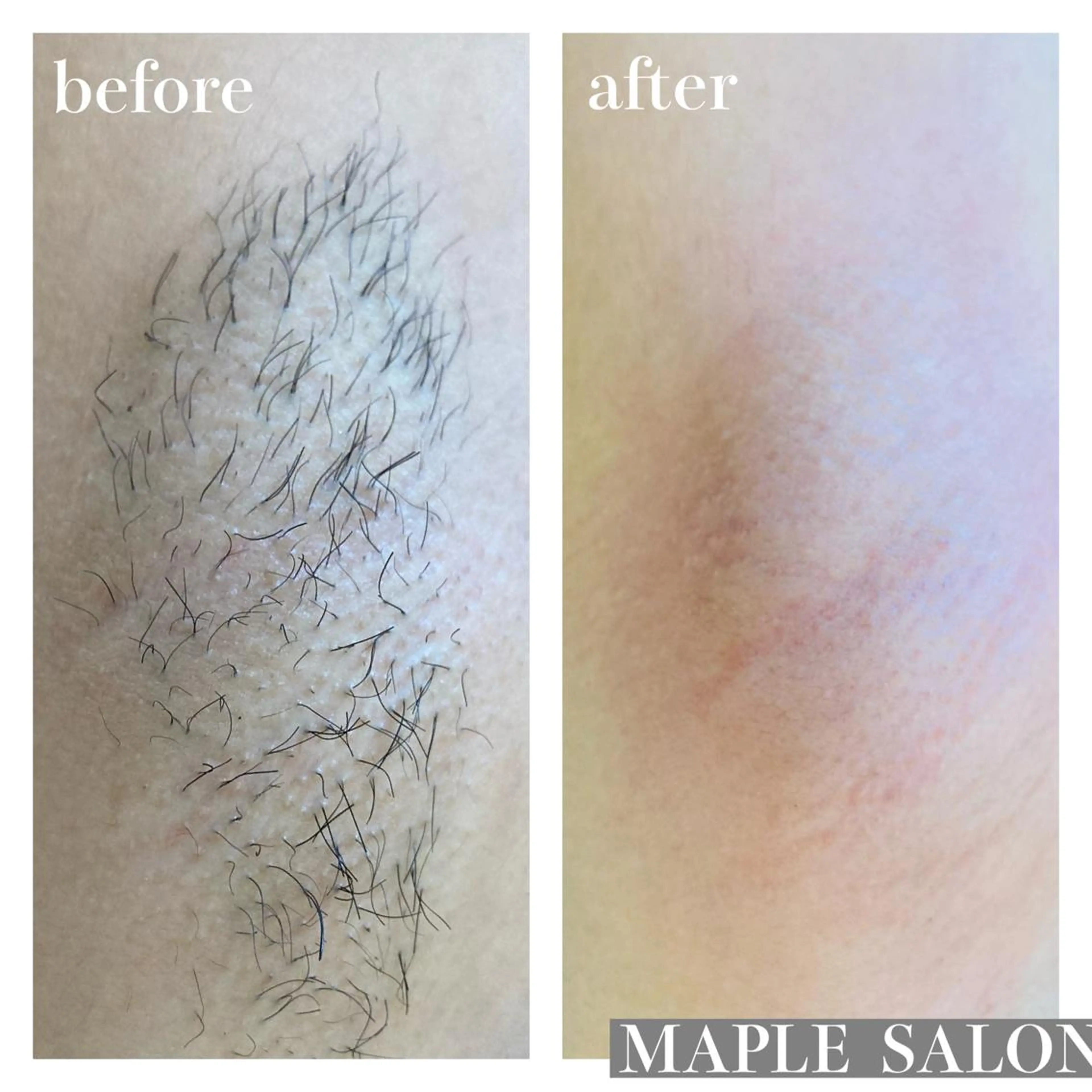 MARI シュガーリストのエステ・リラクイメージ