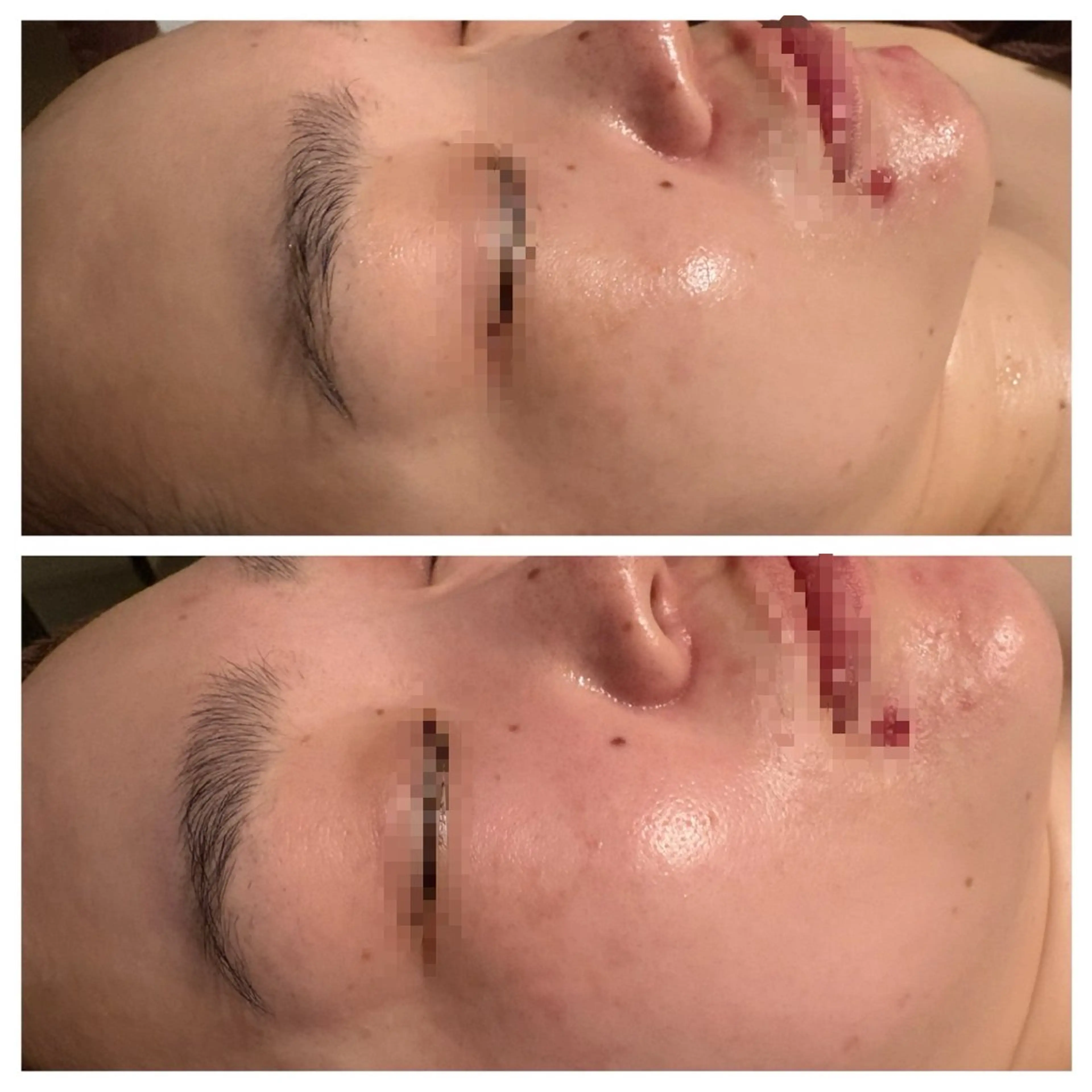 エステ 下北沢KEIKA所属・下北沢KEIKA 【エステサロン】のエステ・リラクイメージ