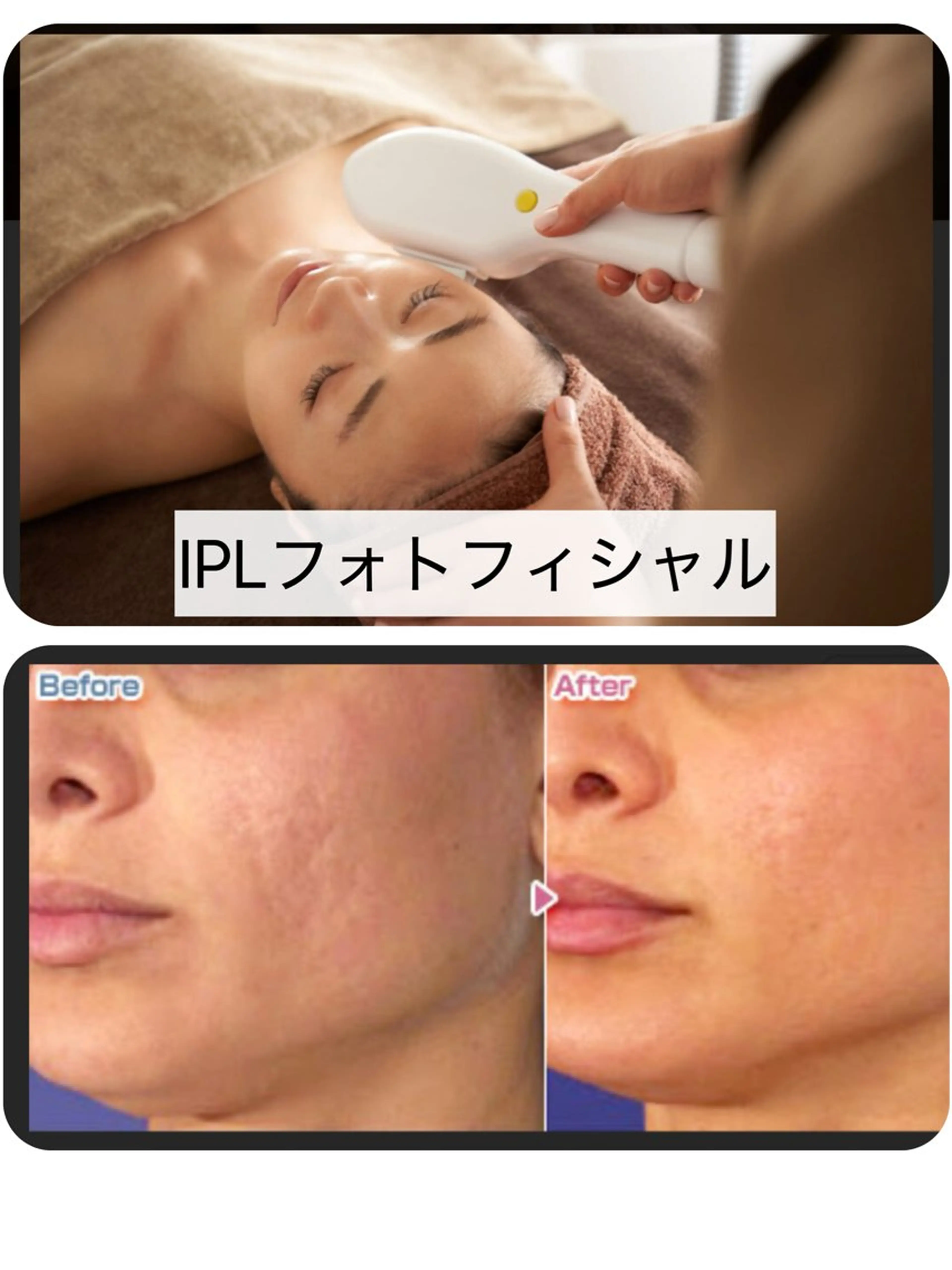 エステ aki_ eyelash_のマツエク・マツパデザイン