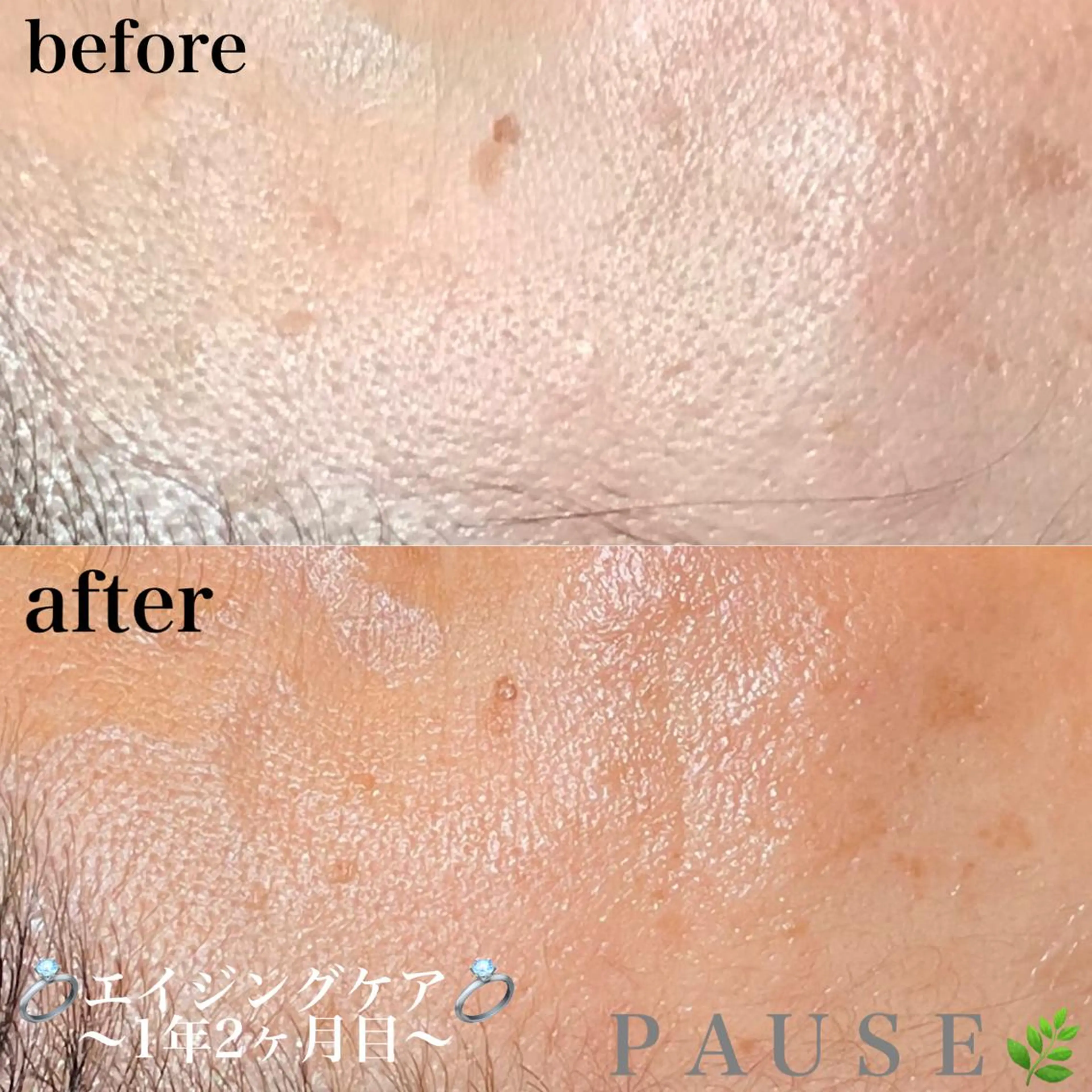 エステ 浜野 恵美のエステ・リラクイメージ