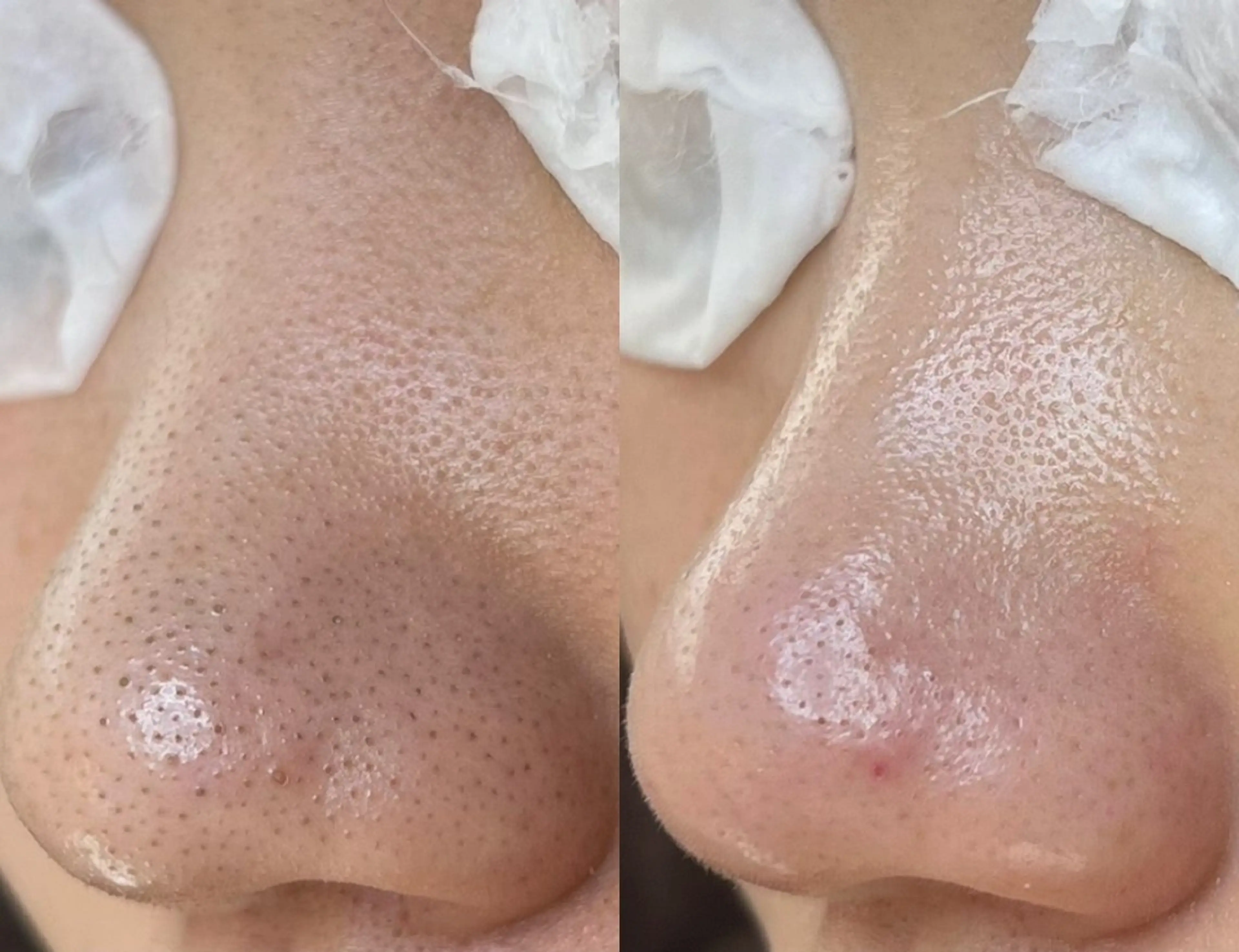 毛穴ツヤ肌専門    Lipulaのエステ・リラクイメージ