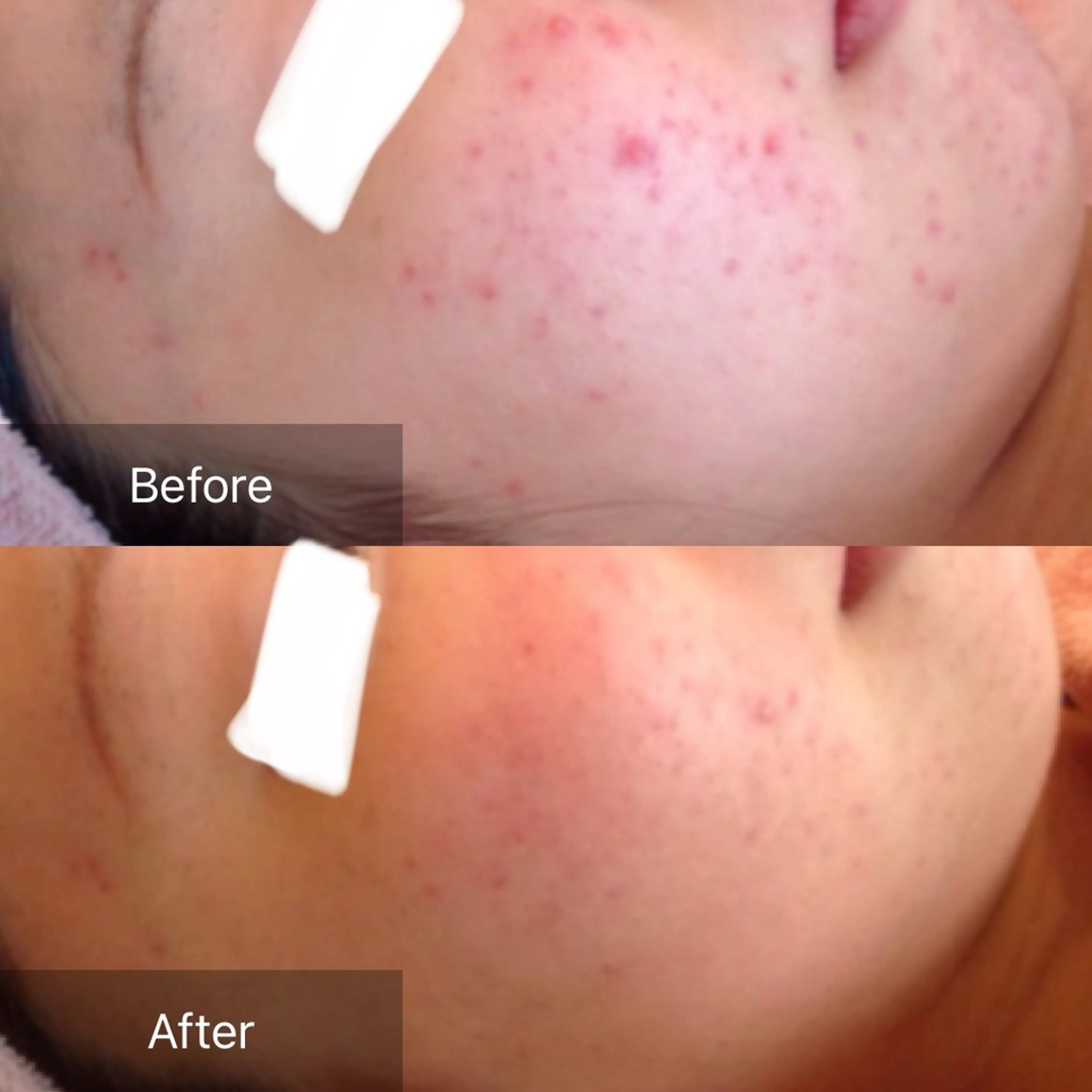 エステ バフトアップ/ハーブ Nornのエステ・リラクイメージ