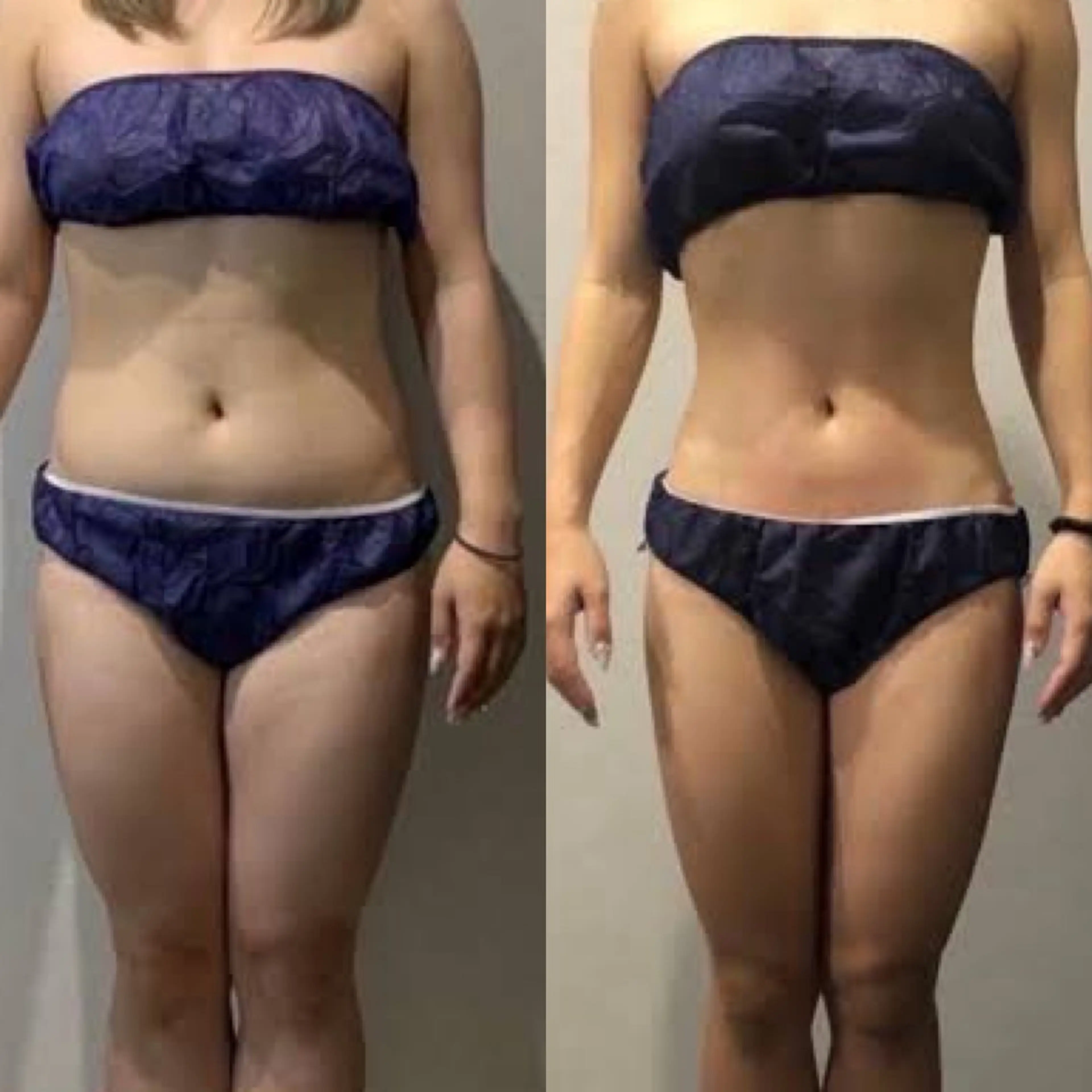 エステ 🦋痩身専門サロン Re:oasis🦋のエステ・リラクイメージ