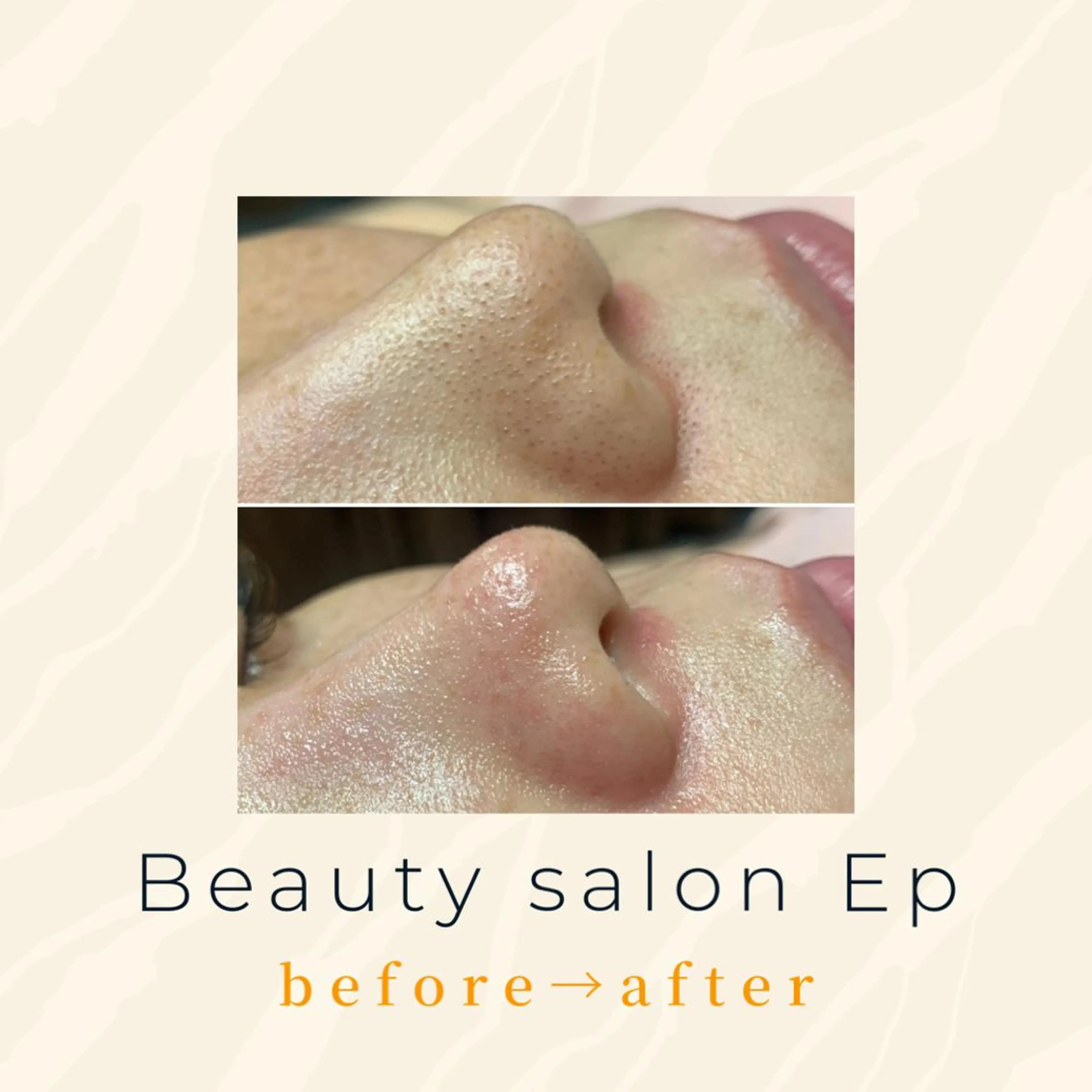 メンズ beauty salon  epのエステ・リラクイメージ