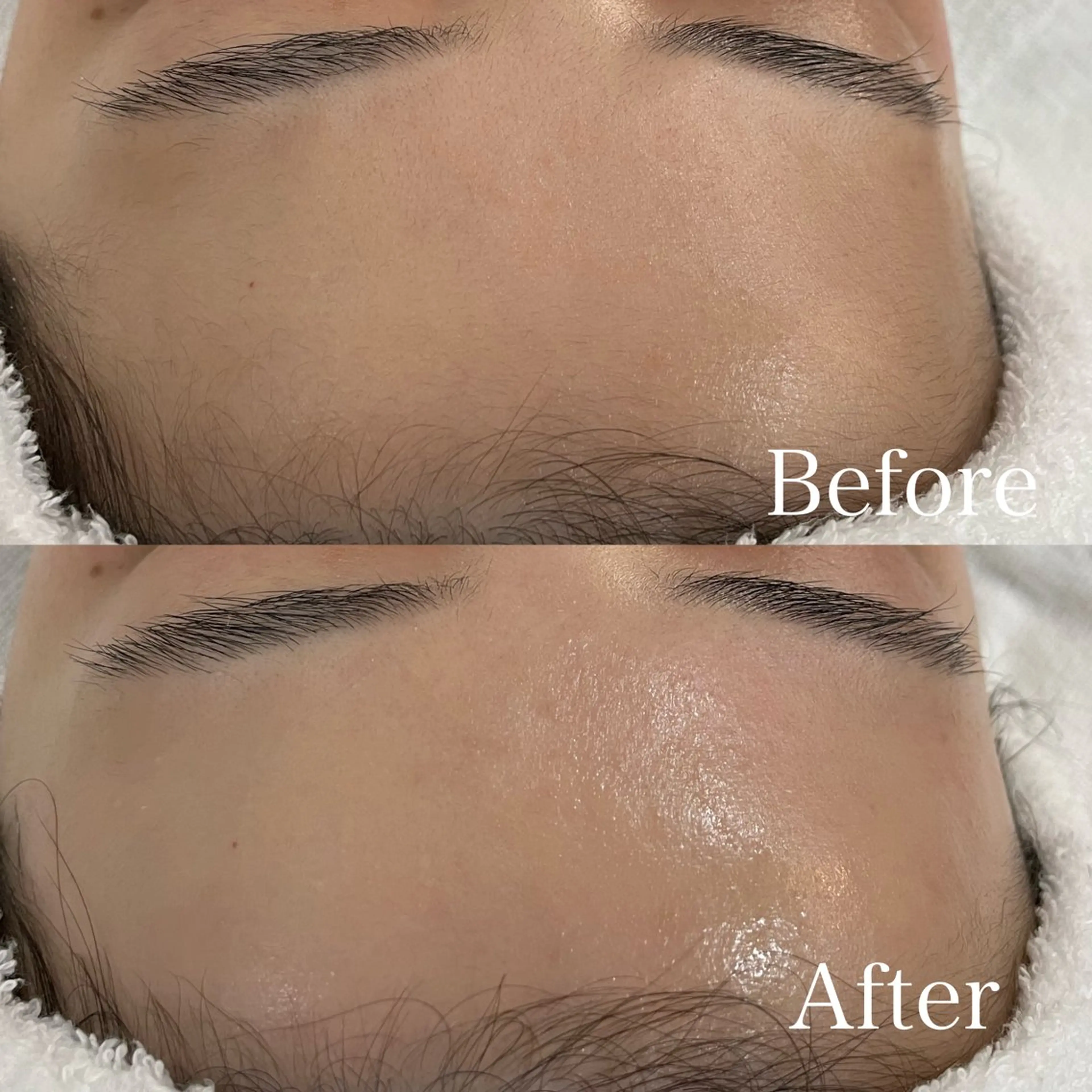 エステ lazo MIYOの眉毛・アイブロウイメージ