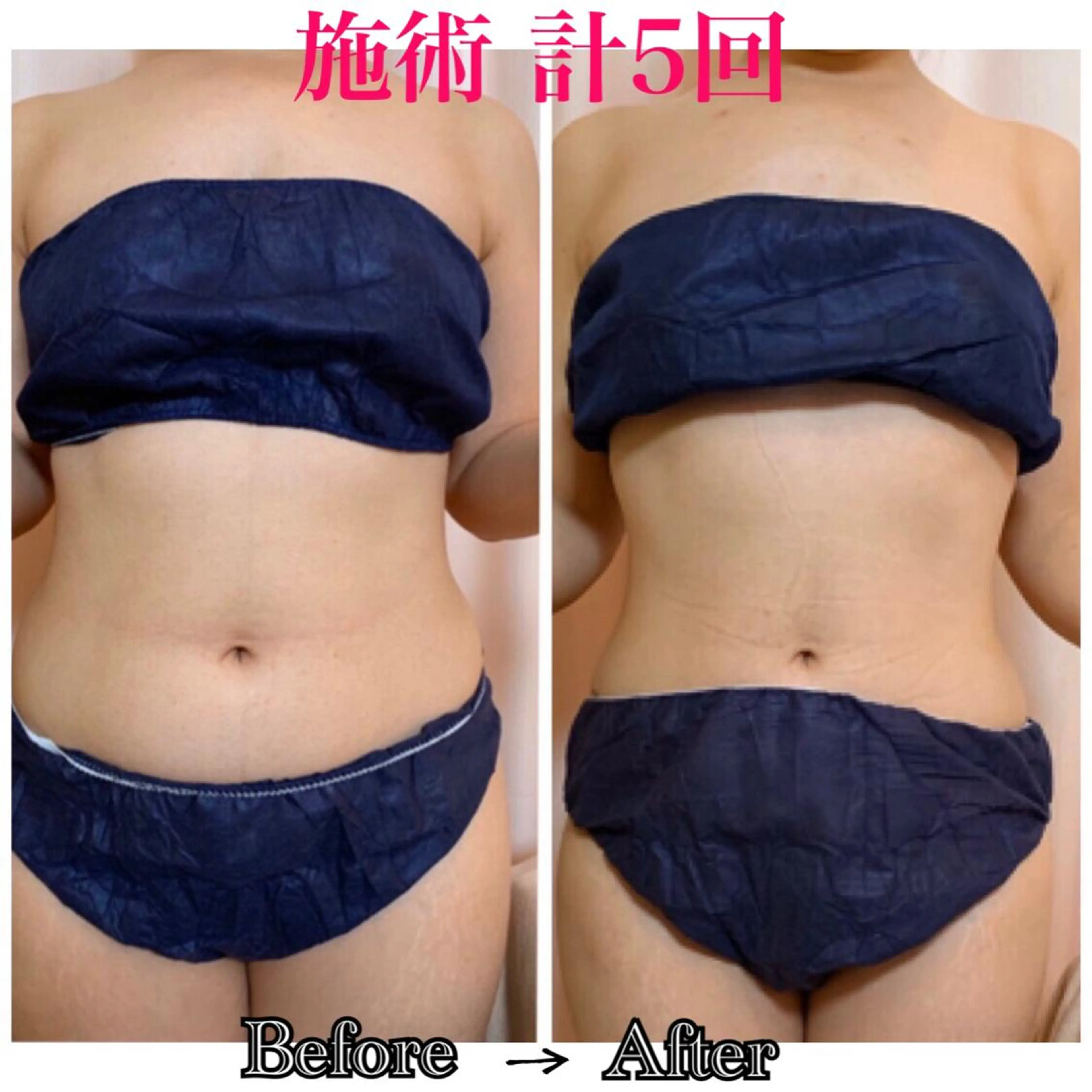 &. BYのエステ・リラクイメージ