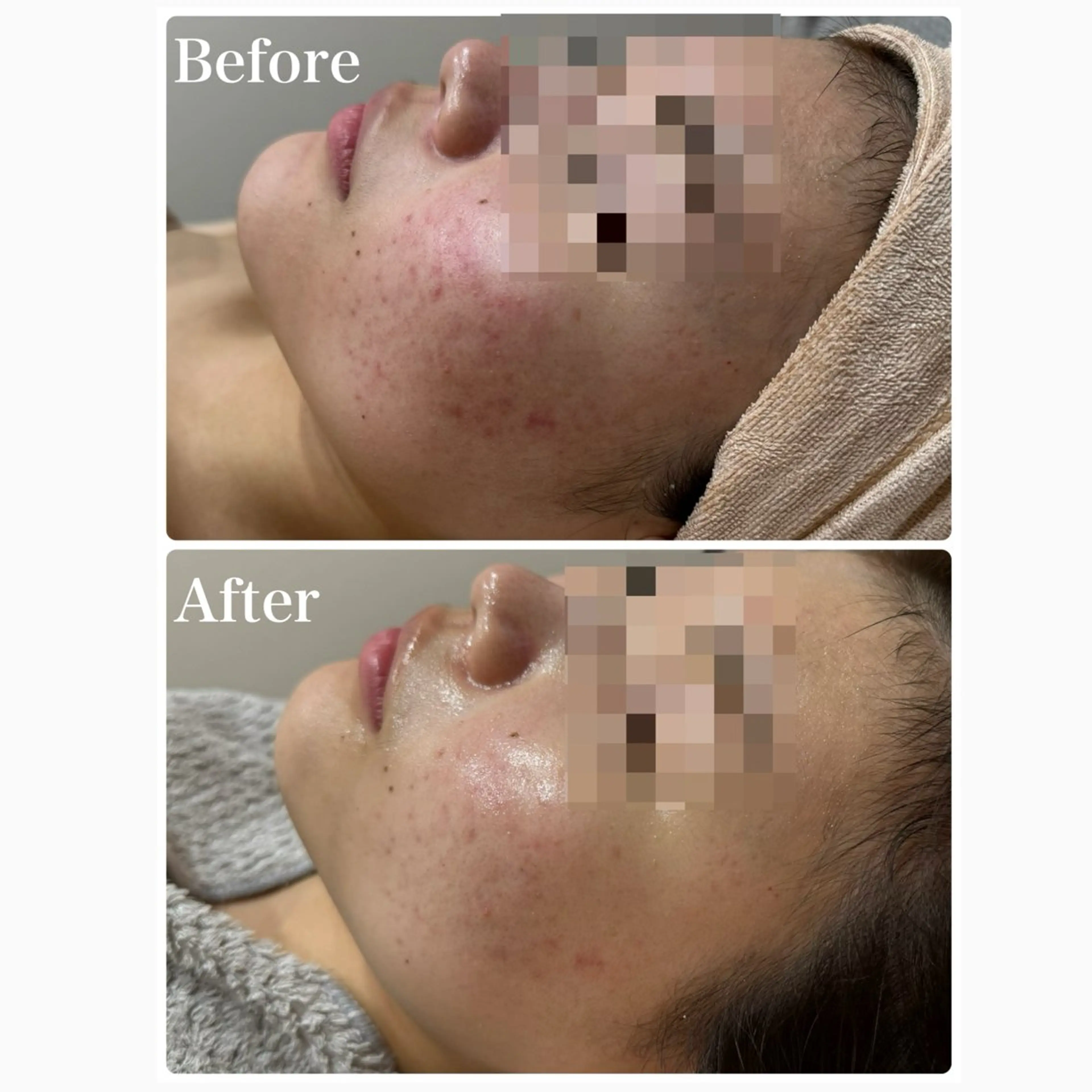 エステ 脱毛&フェイシャル 専門店muro.のエステ・リラクイメージ