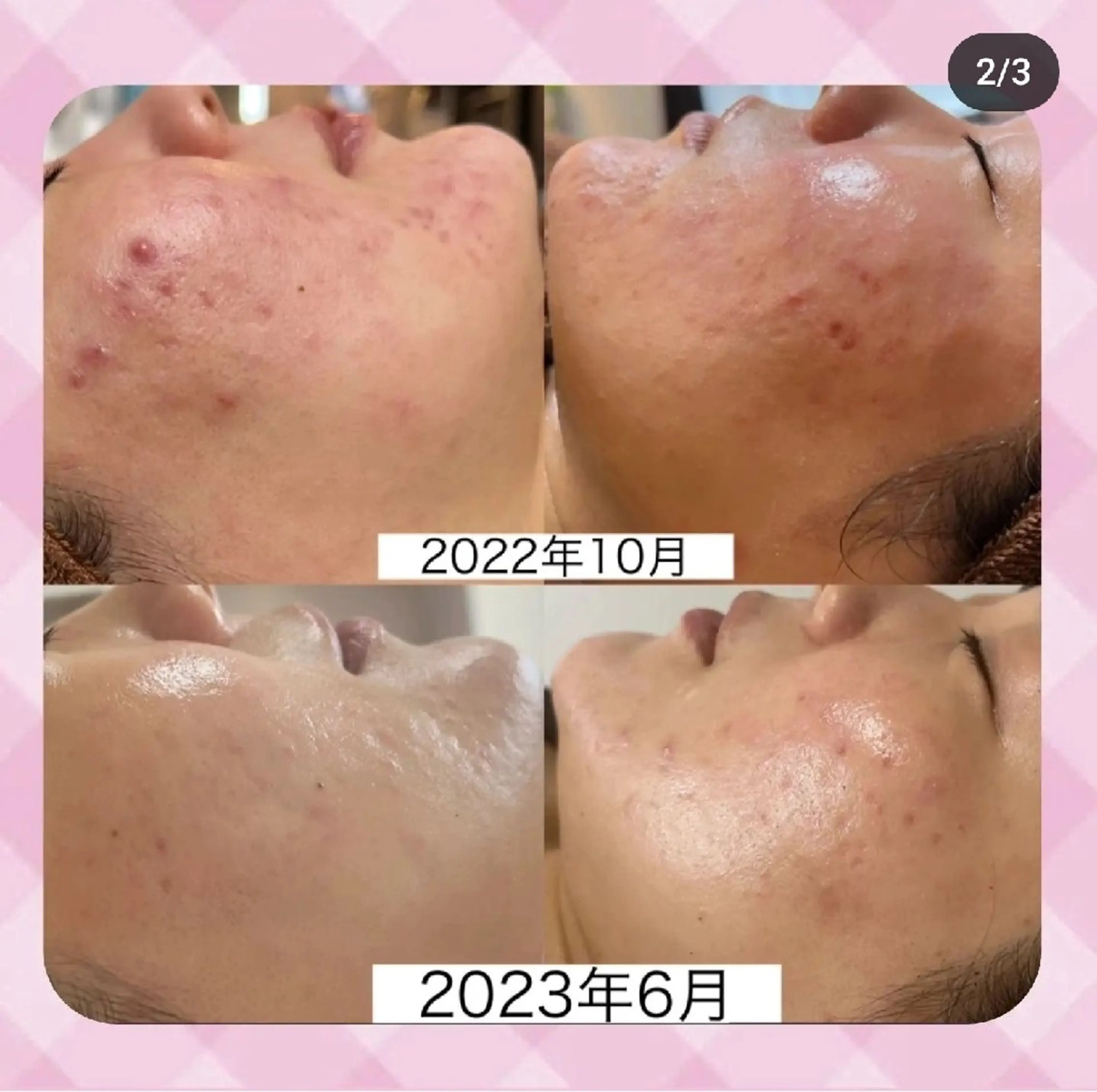 MI KUのエステ・リラクイメージ