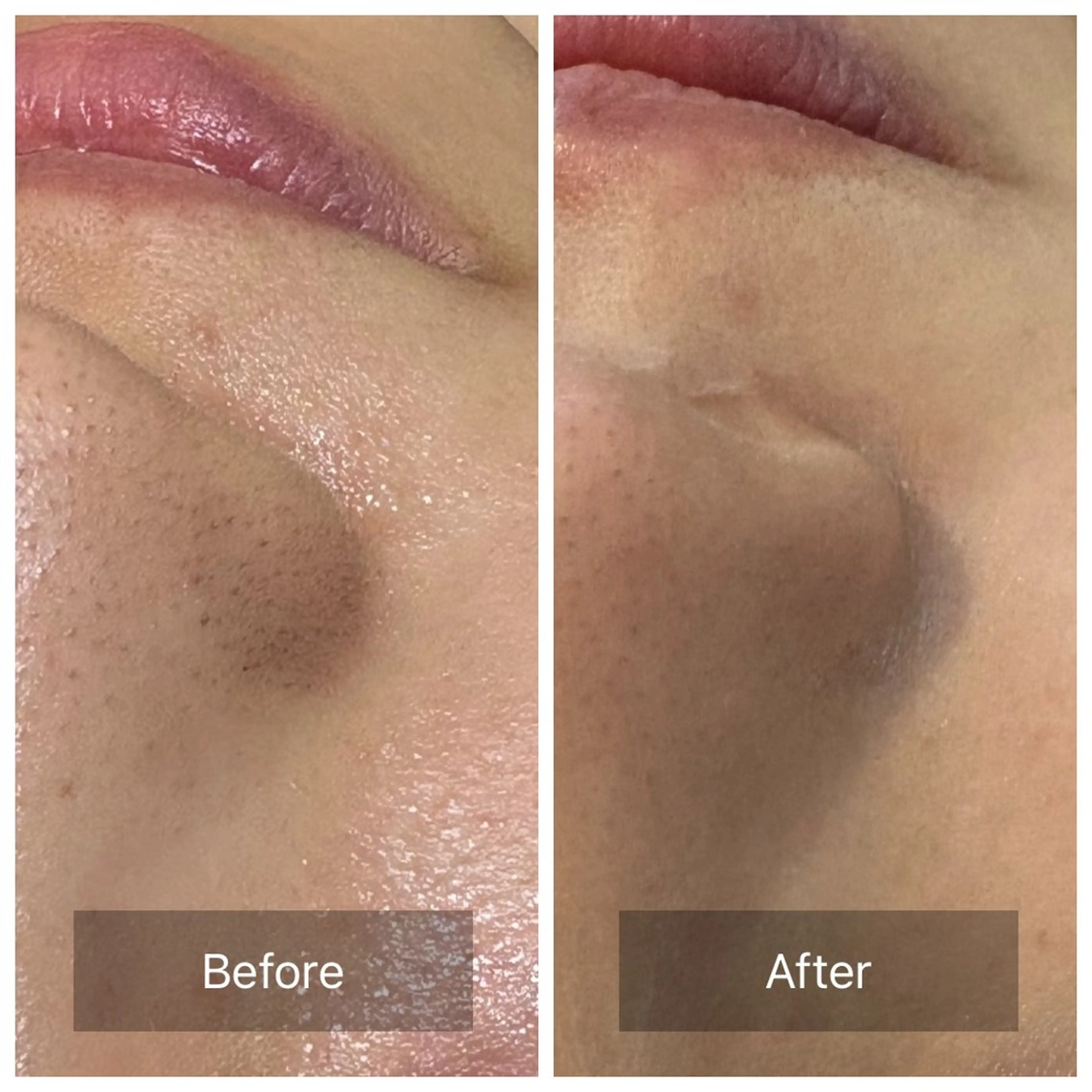 エステ LIAN リアンのエステ・リラクイメージ