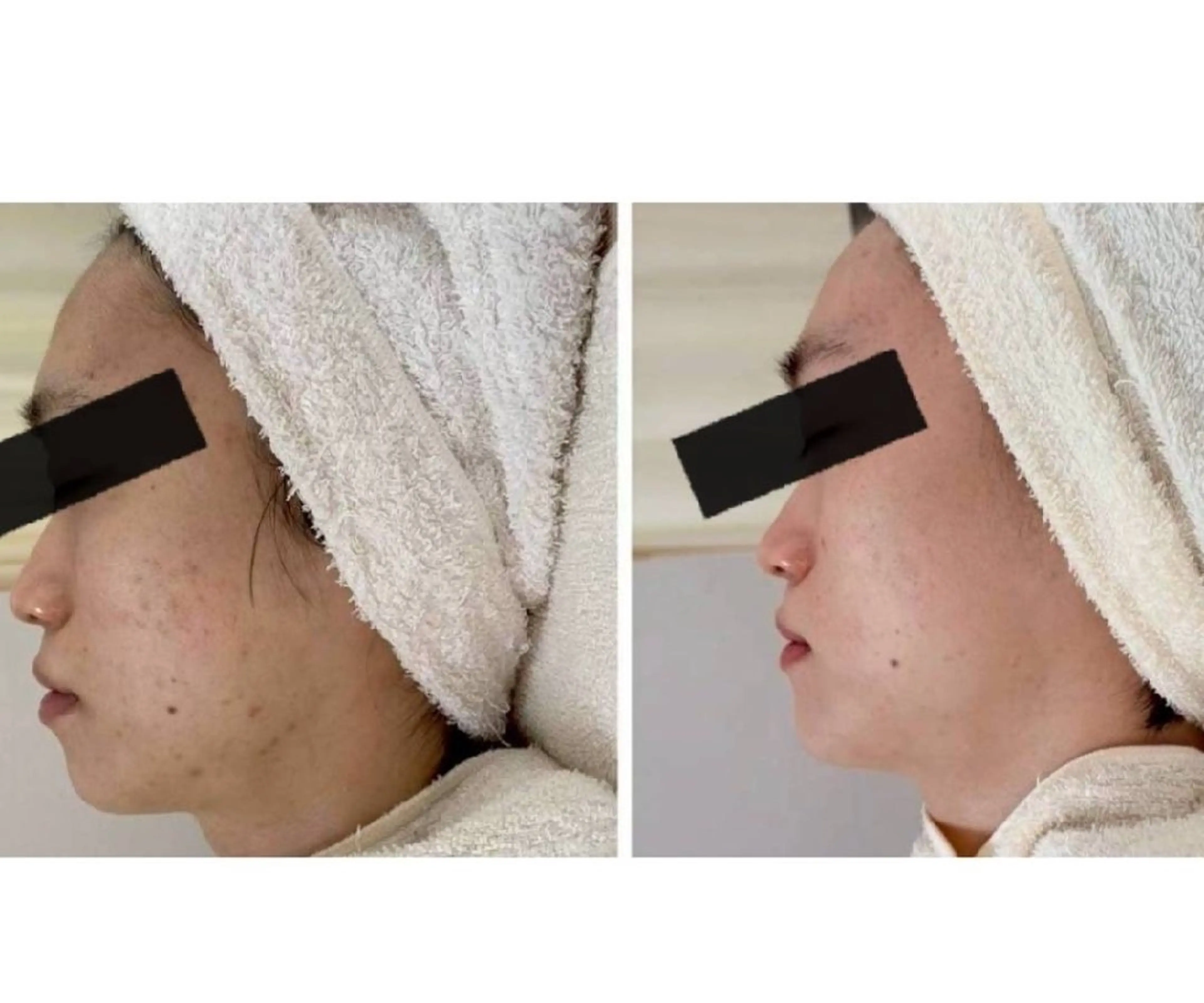 メンズ エステ 〈ニキビケアサロン〉 レゾン京橋店/ 浅川のエステ・リラクイメージ