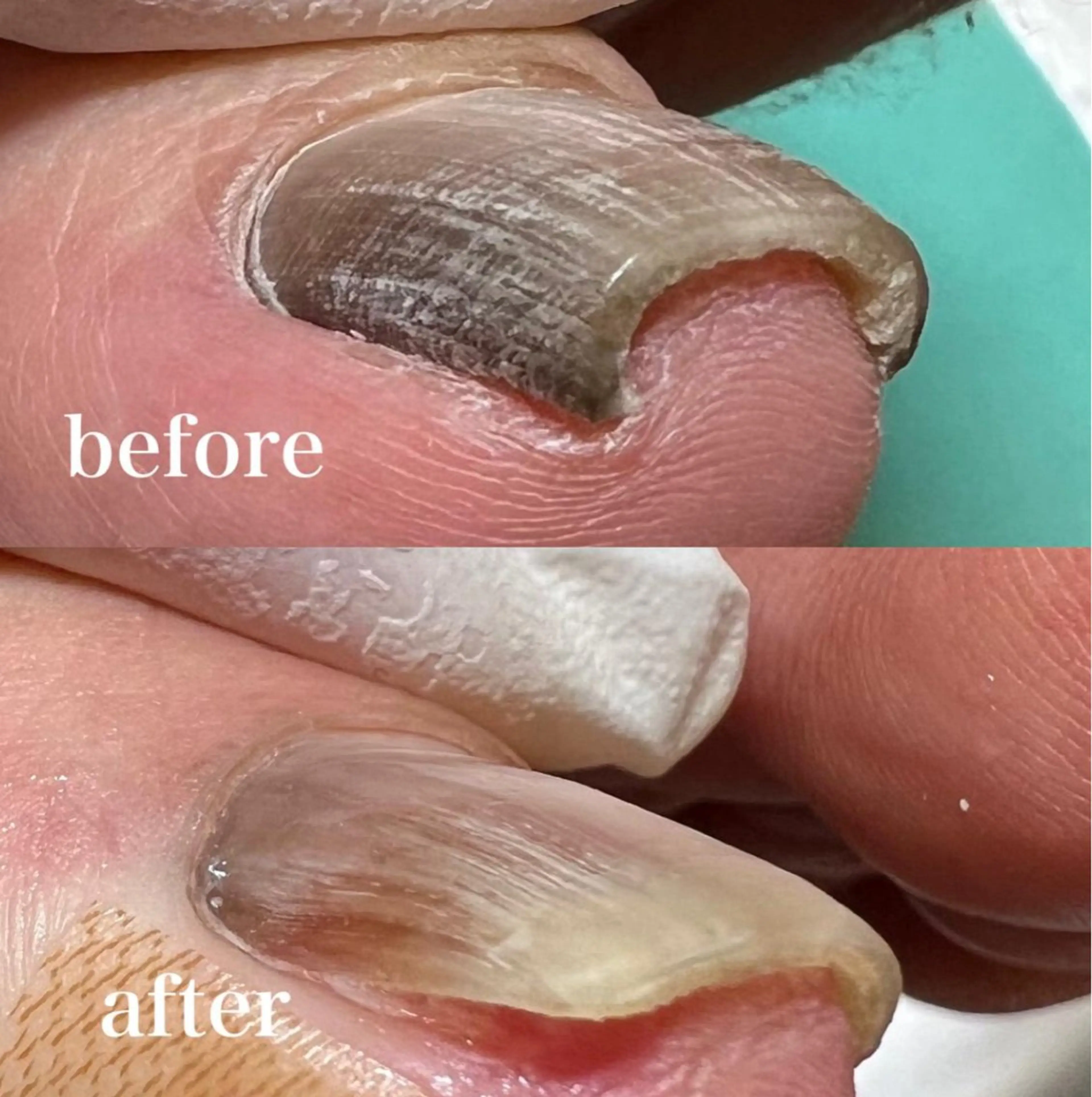 リラク 福岡巻き爪補正店 博多店のエステ・リラクイメージ