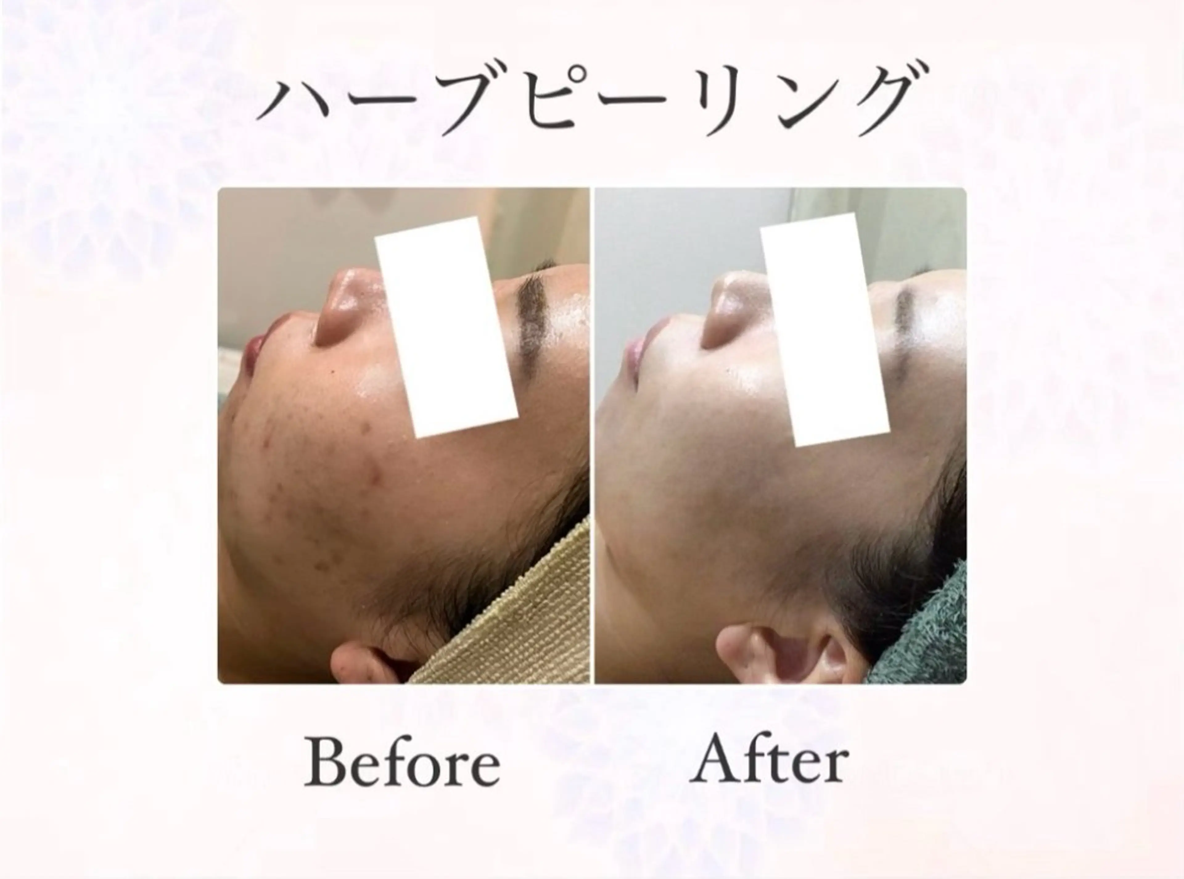 脱毛&フェイシャル 専門店muro.のエステ・リラクイメージ