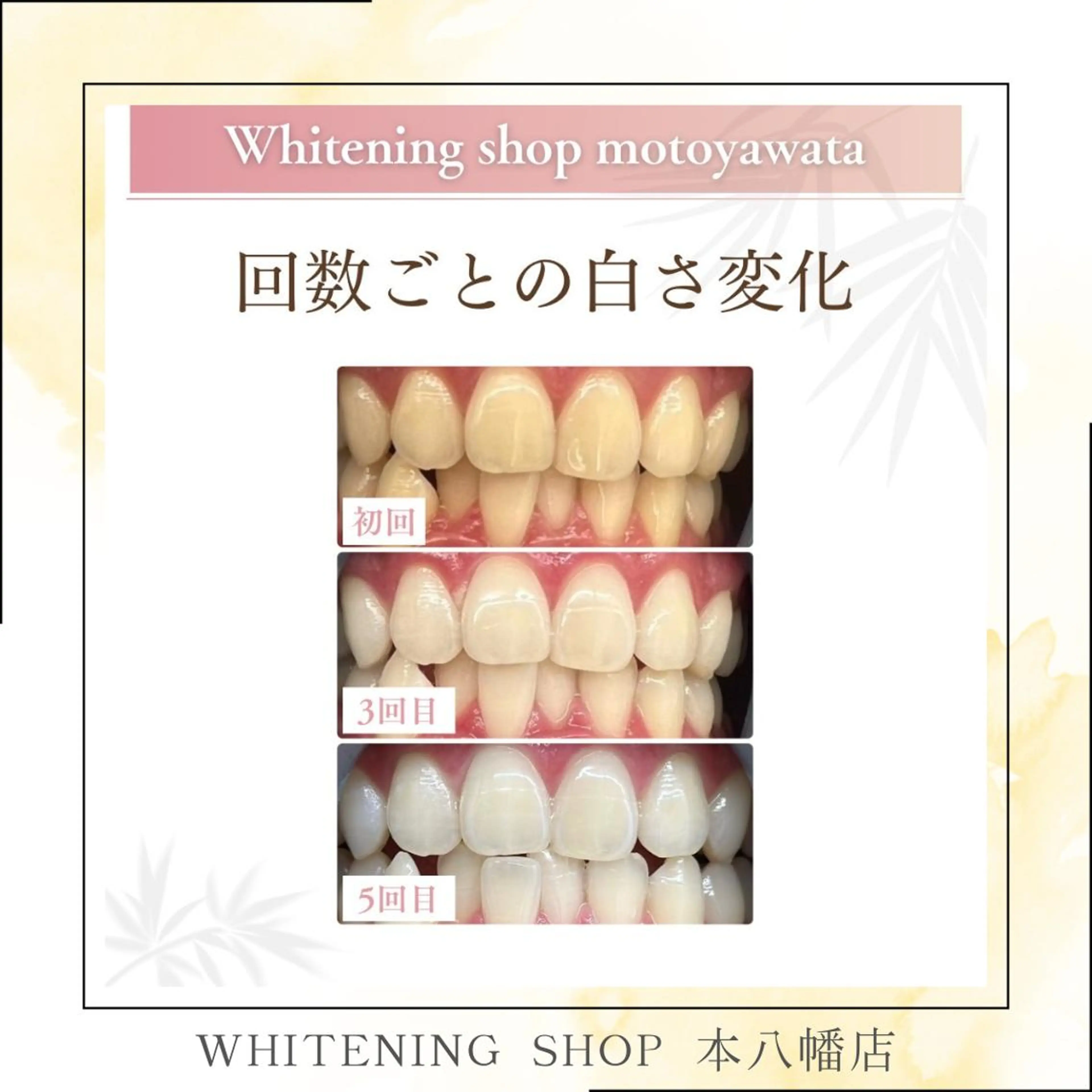 メンズ エステ リラク ホワイトニング ショップ本八幡店のエステ・リラクイメージ