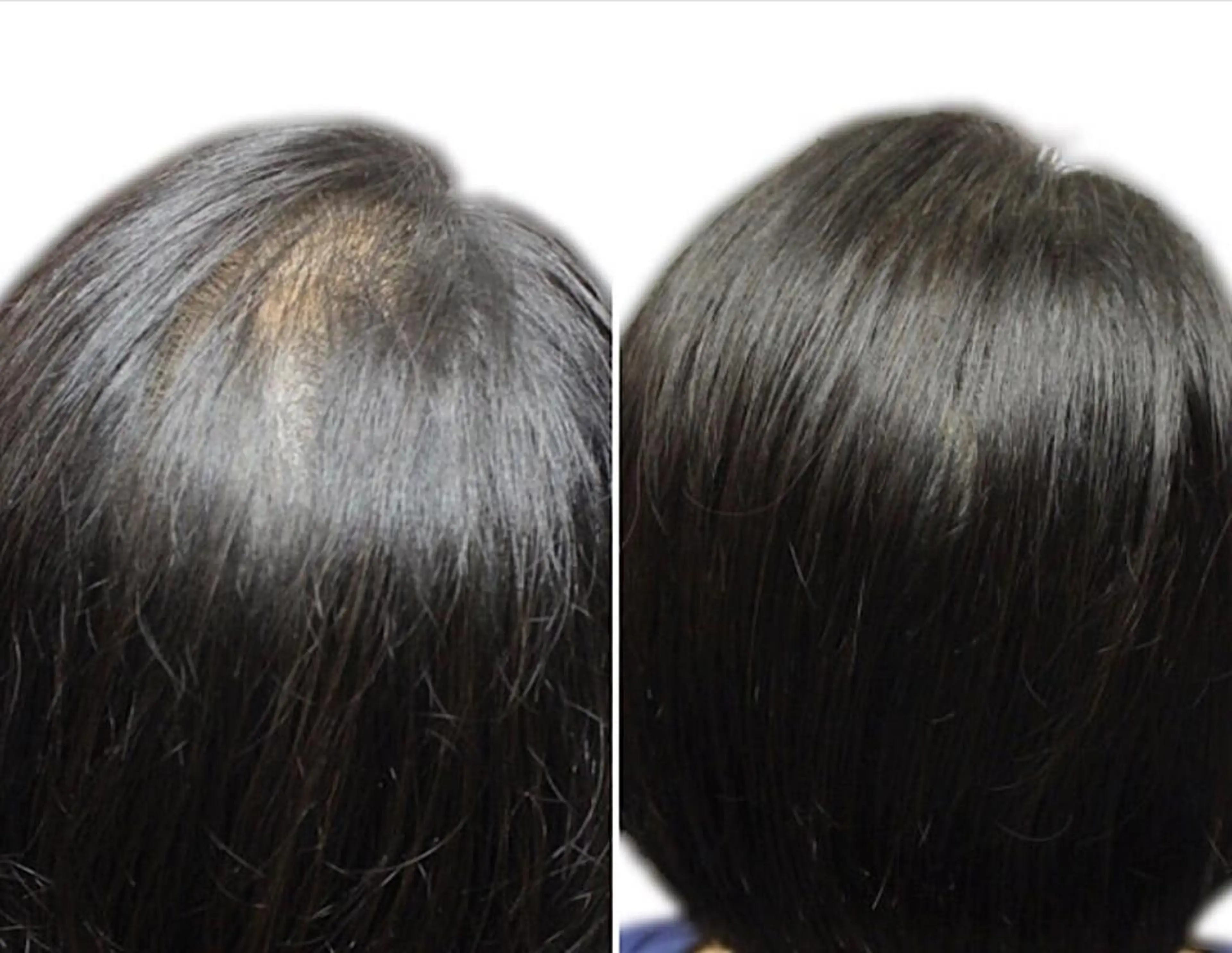 増毛エクステ100本～の写真