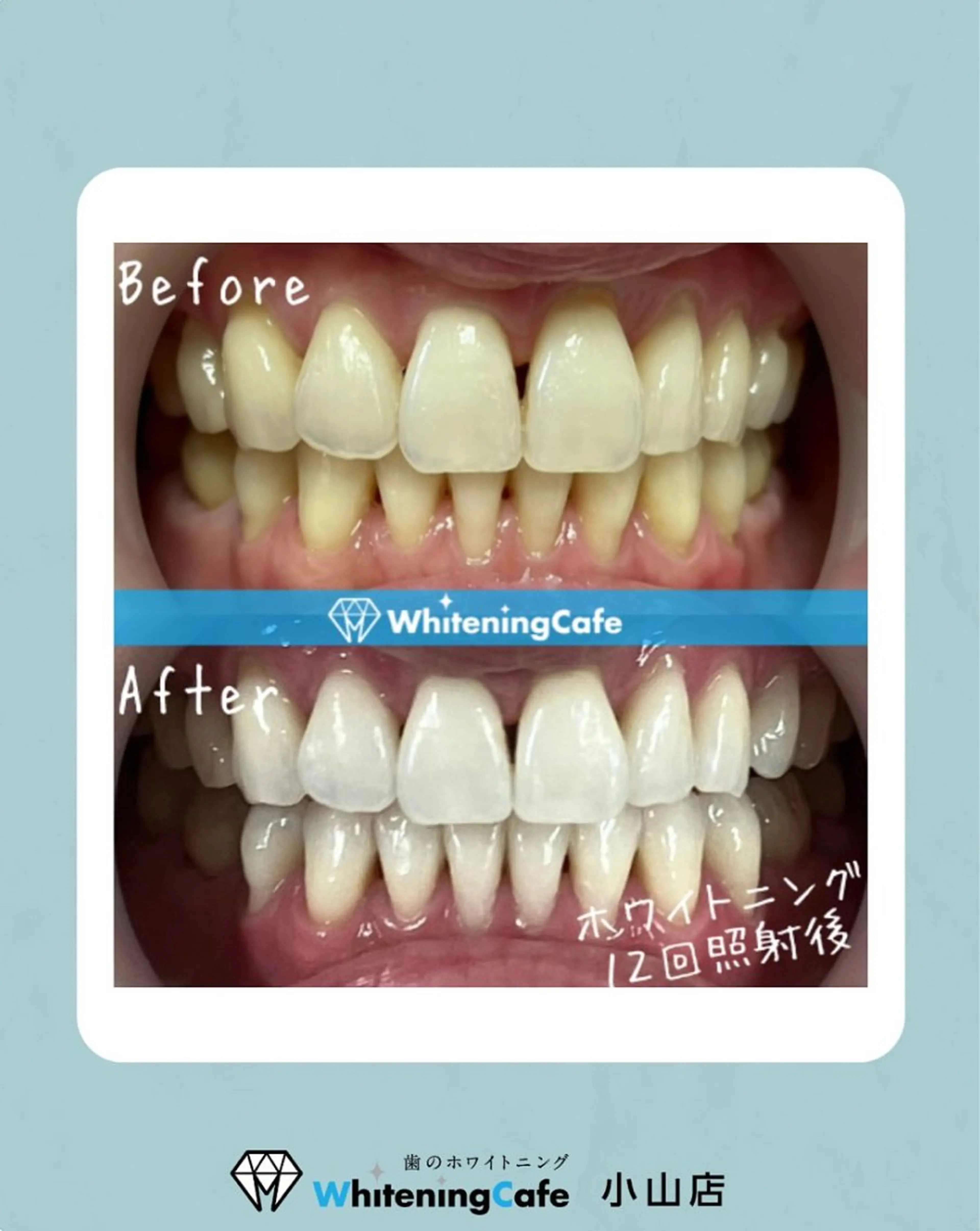 ホワイトニングカフェ 小山店のエステ・リラクイメージ