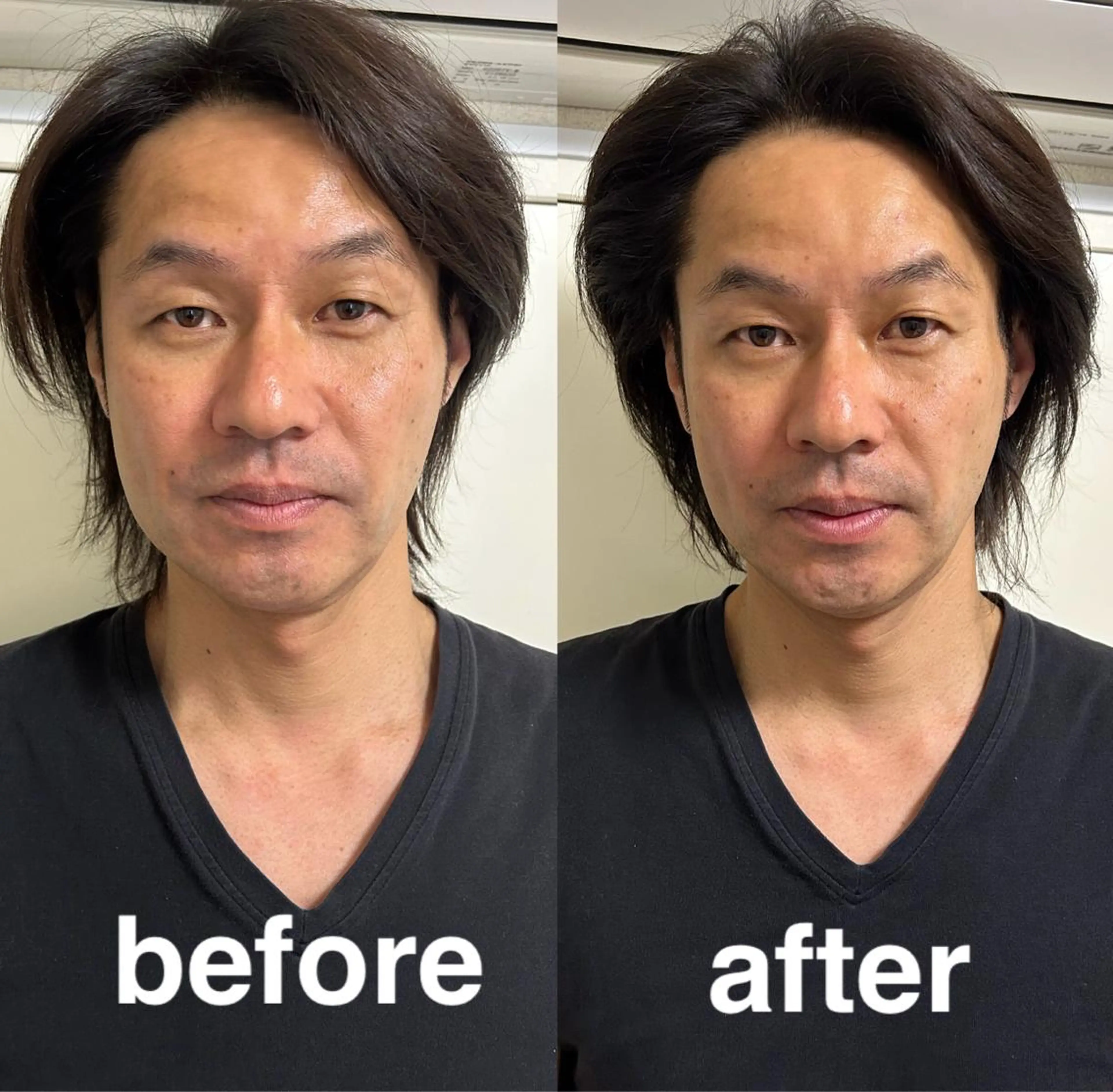 その他 美容鍼灸サロン mahoroba院長のエステ・リラクイメージ