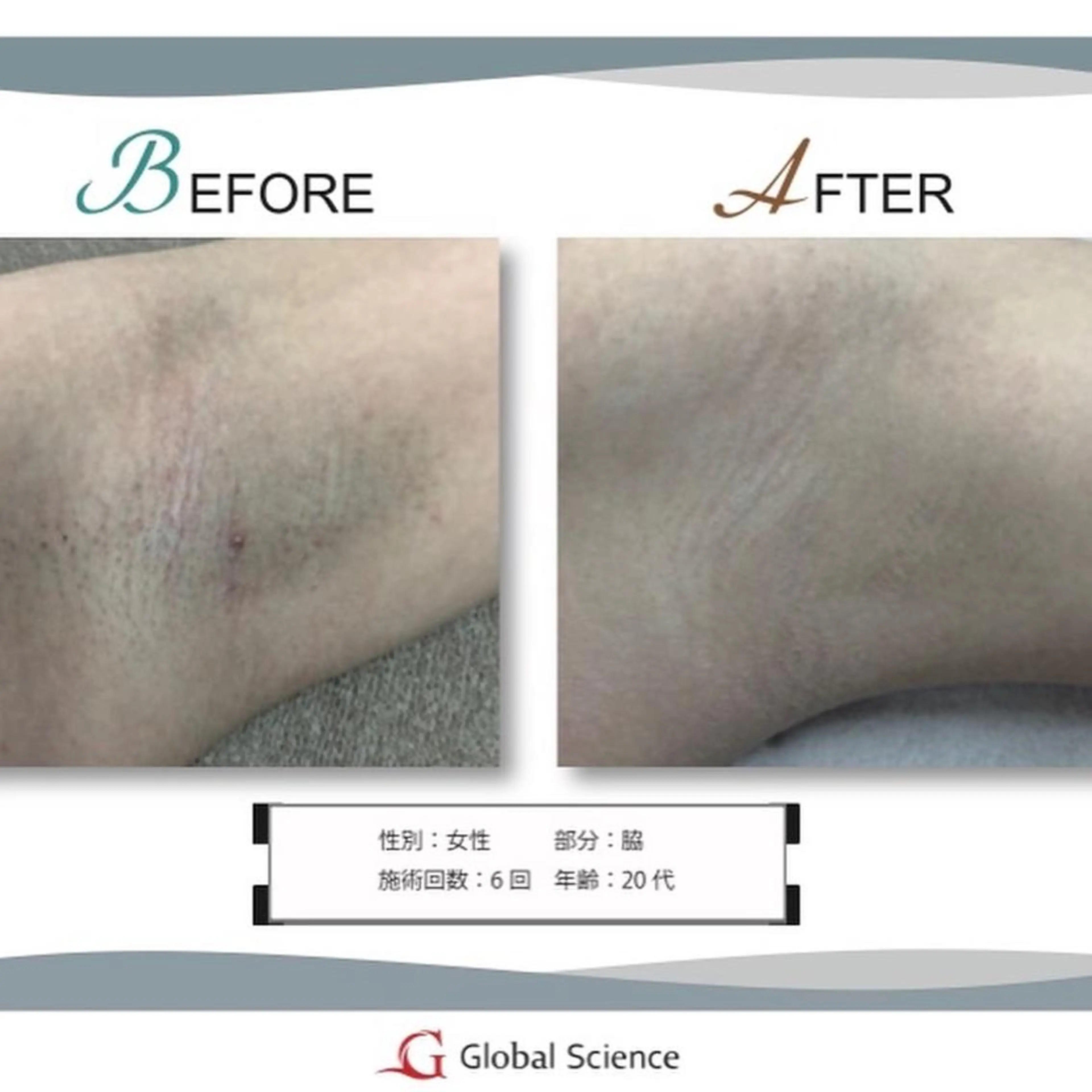 melia 岡山駅前店のエステ・リラクイメージ