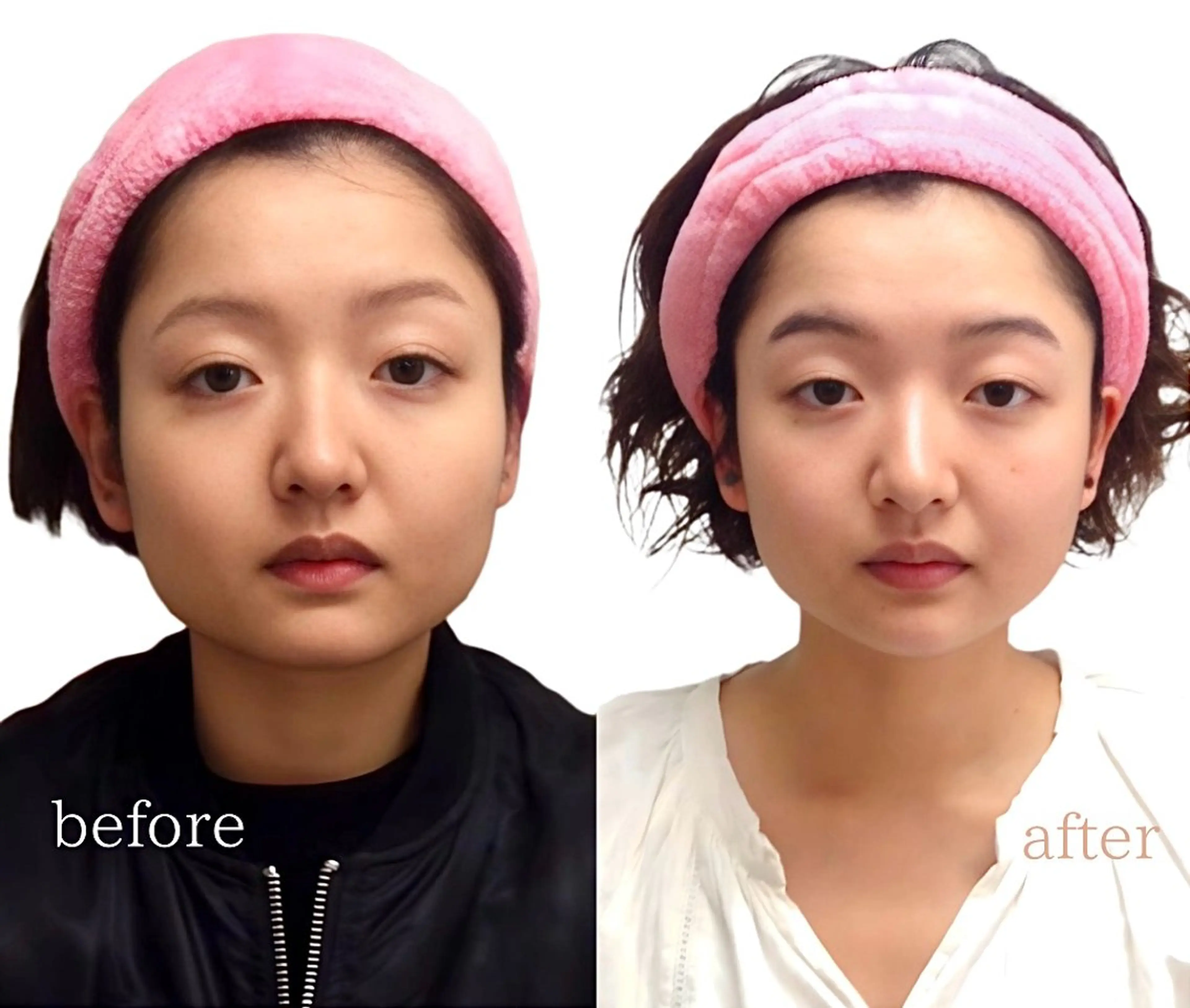 オススメ【小顔美肌コルギ】首肩コリ/疲労/コルギ/小顔矯正の写真