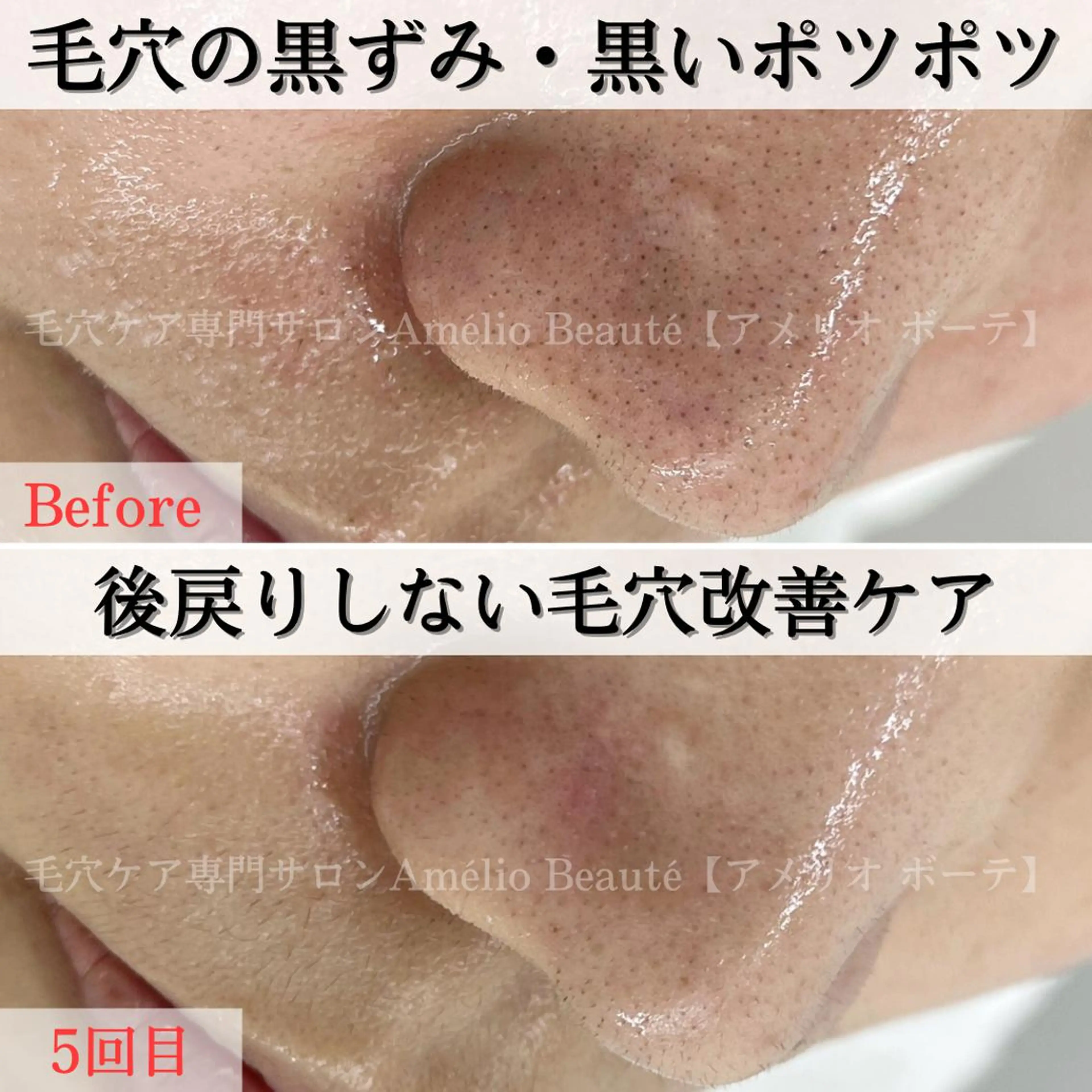 毛穴ケア専門サロン アメリオボーテのその他イメージ