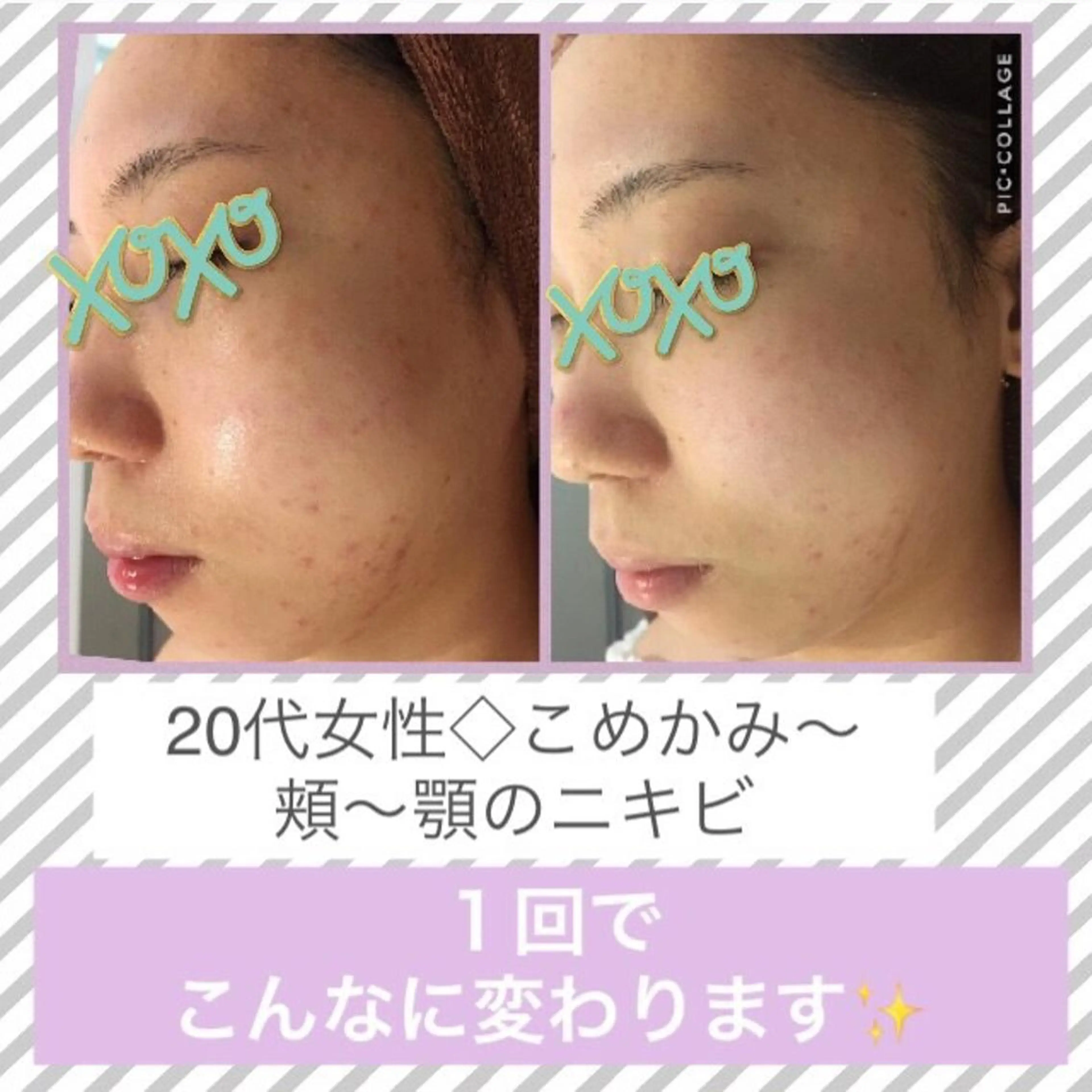 ミディアム カラー パーマ ヘアアレンジ メンズ キッズ ネイル マツエク・マツパ ニキビ・肌質改善専門 ♡人生が変わるサロンのエステ・リラクイメージ