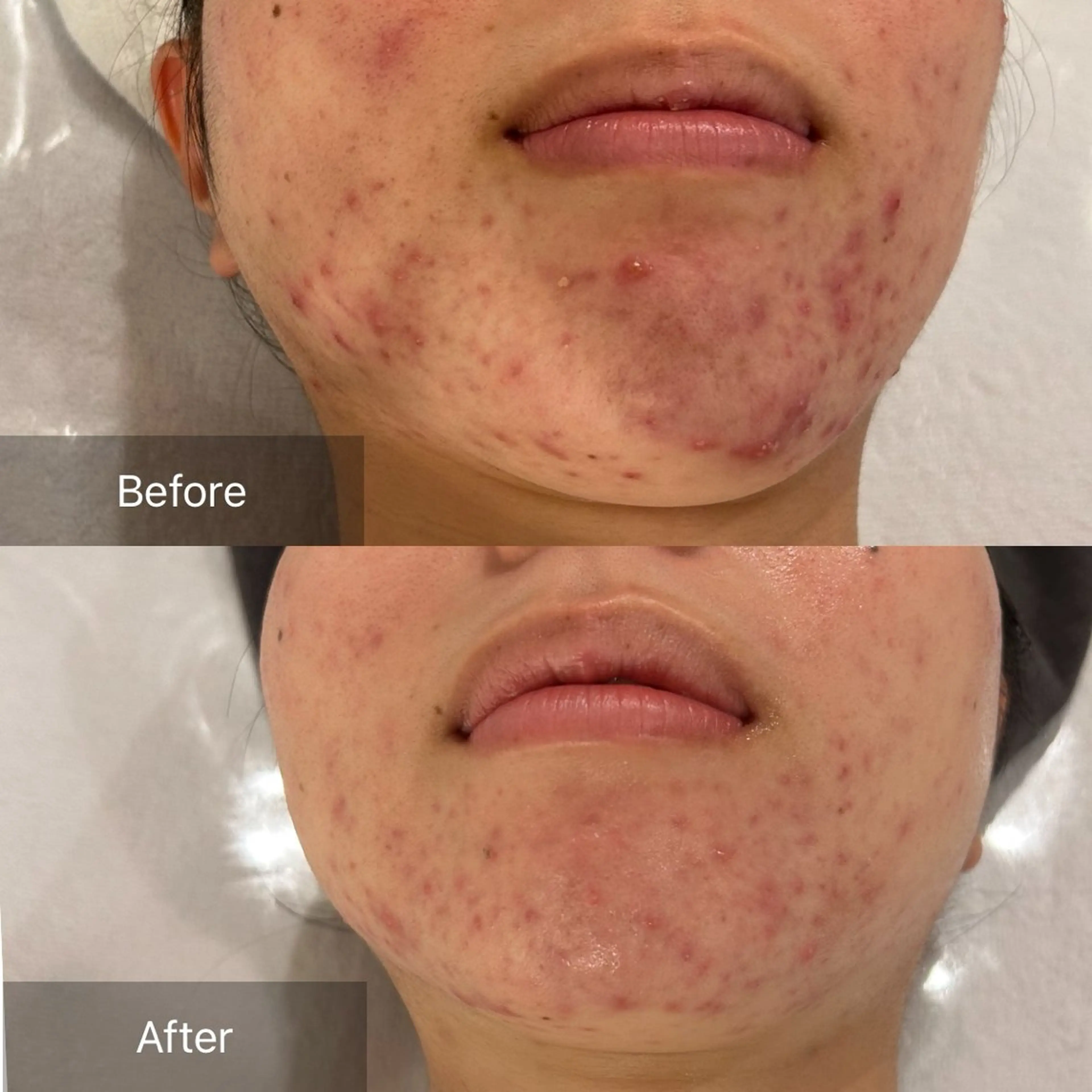 mine.mi マインエムのエステ・リラクイメージ